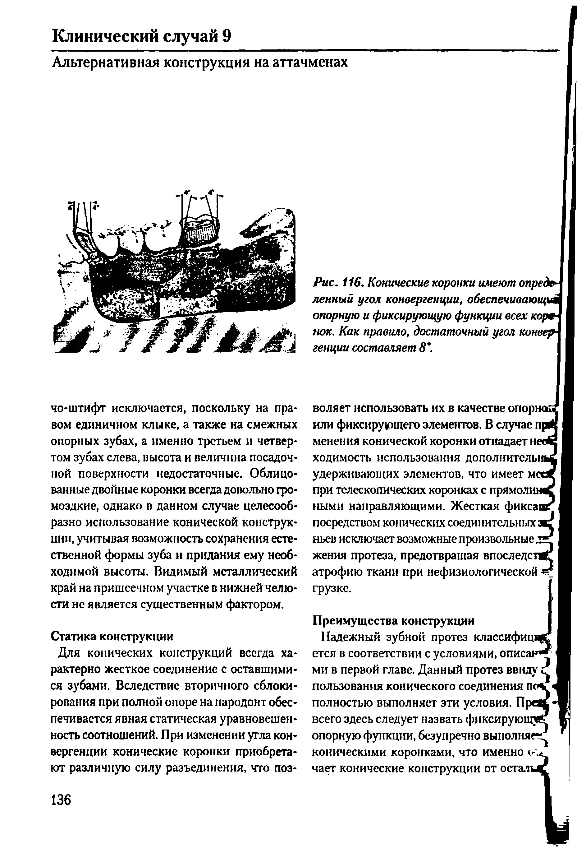 Рис. 116. Конические коронки имеют опреб ленный угол конвергенции, обеспечивают , опорную и фиксирующую функции всех кор нок. Как правило, достаточный угол конве генции составляет 8".