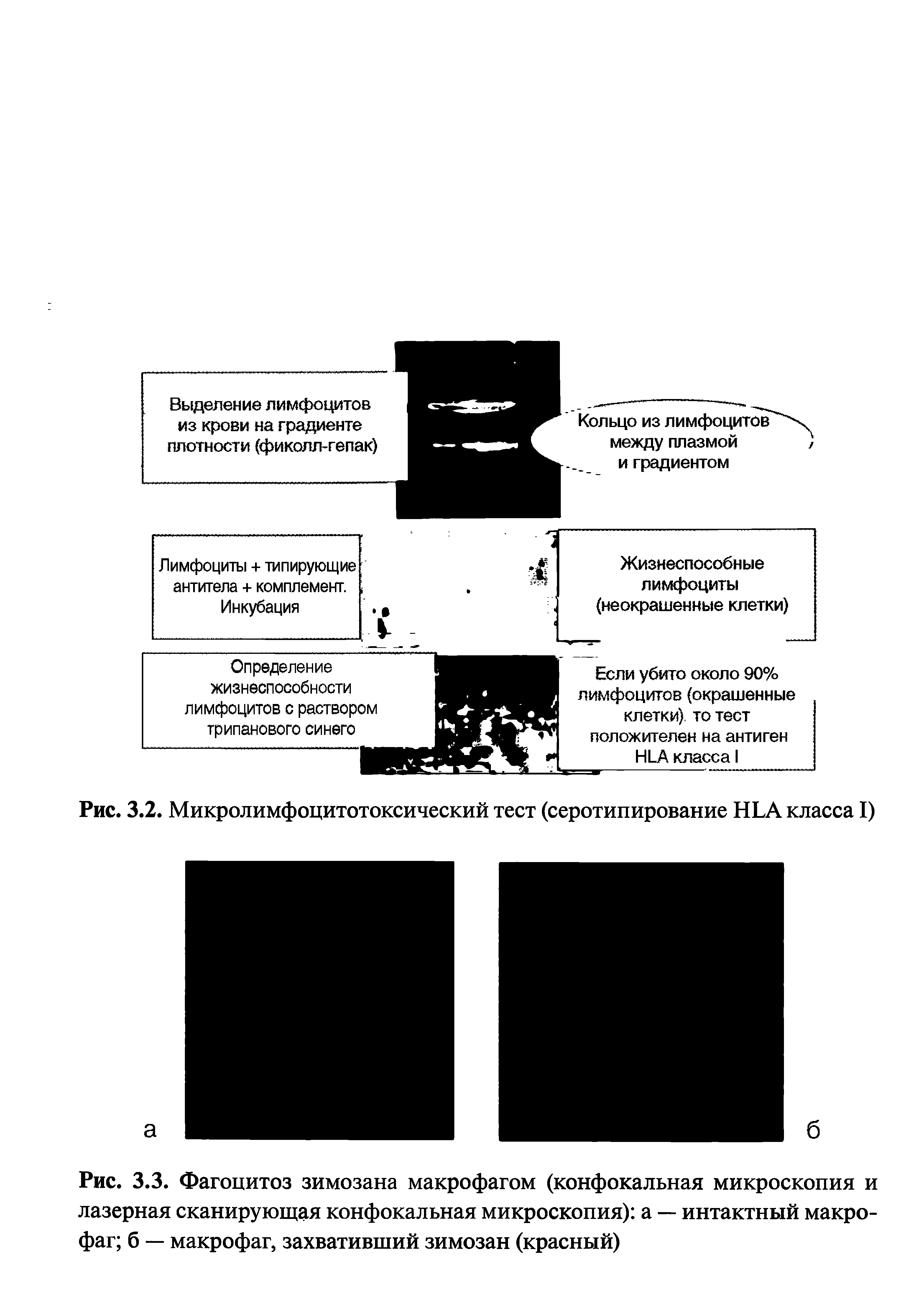 Рис. 3.3. Фагоцитоз зимозана макрофагом (конфокальная микроскопия и лазерная сканирующая конфокальная микроскопия) а — интактный макрофаг б — макрофаг, захвативший зимозан (красный)...