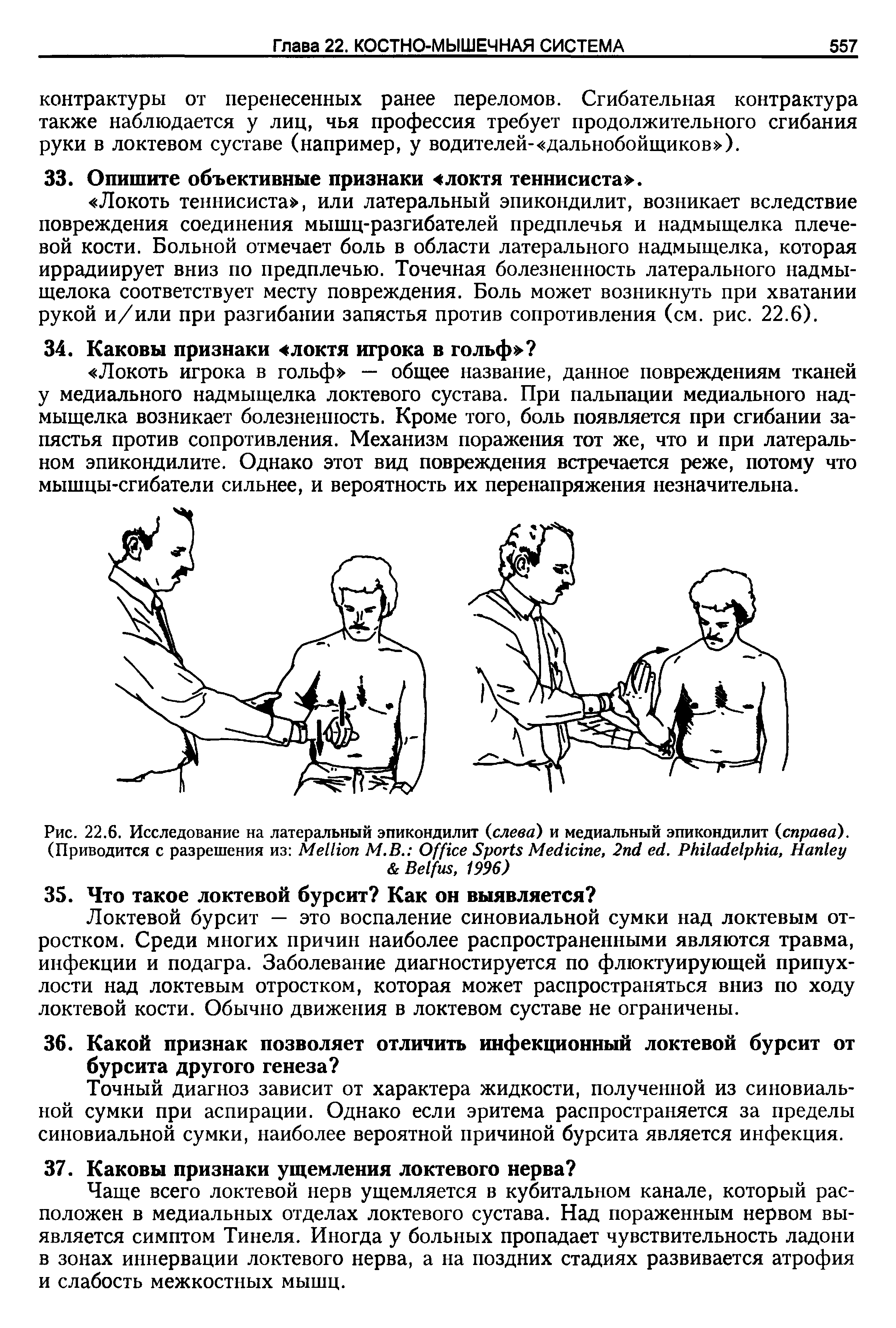 Рис. 22.6. Исследование на латеральный эпикондилит слева) и медиальный эпикондилит справа). (Приводится с разрешения из M М.В. O S M , 2 . P , H B , 1996)...