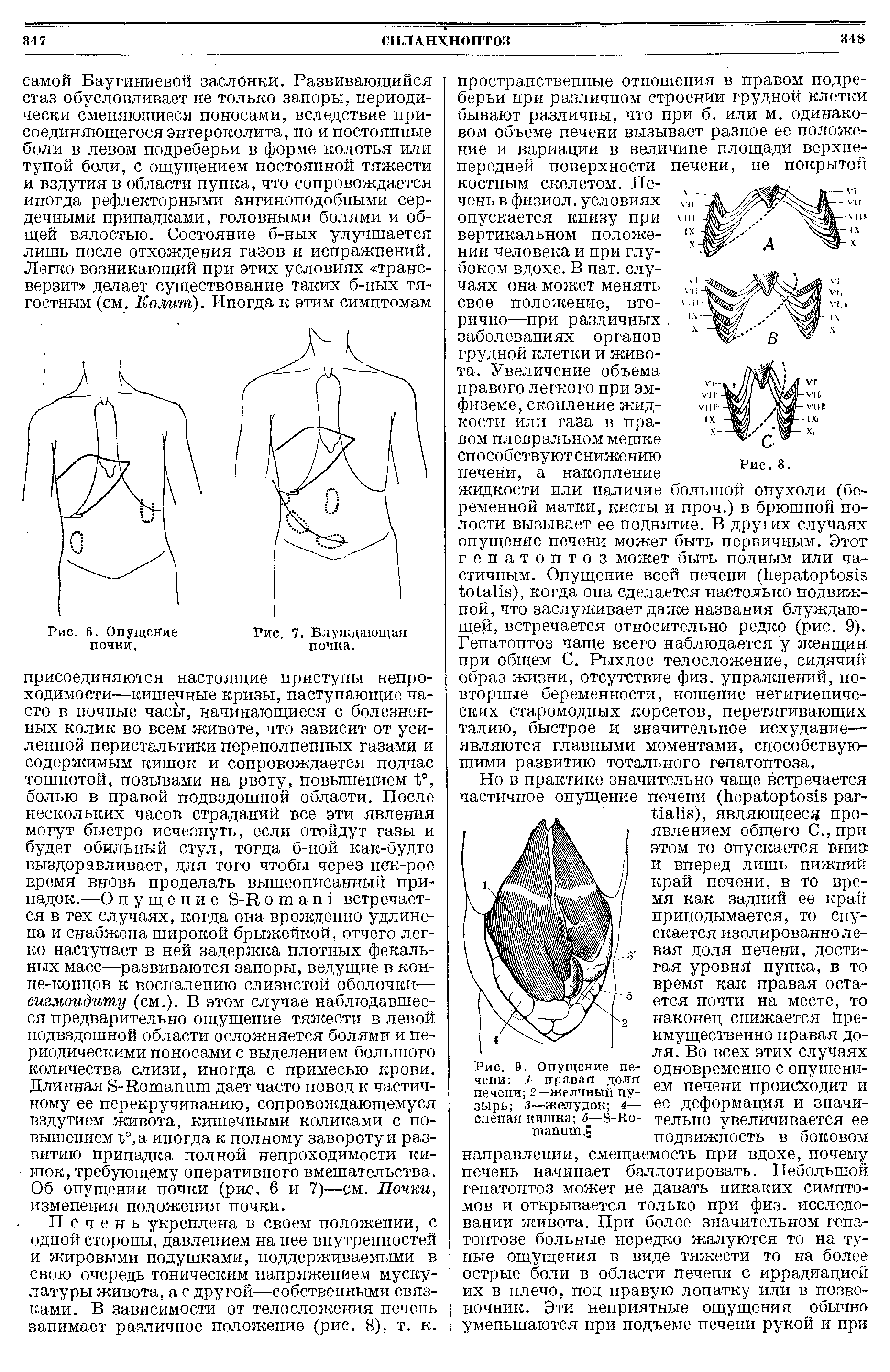 Рис. 9. Опущение пе-чени /—правая доля печени 2—желчный пузырь 3—желудок 4— слепая кишка 5—8-Во-тпапит.К...