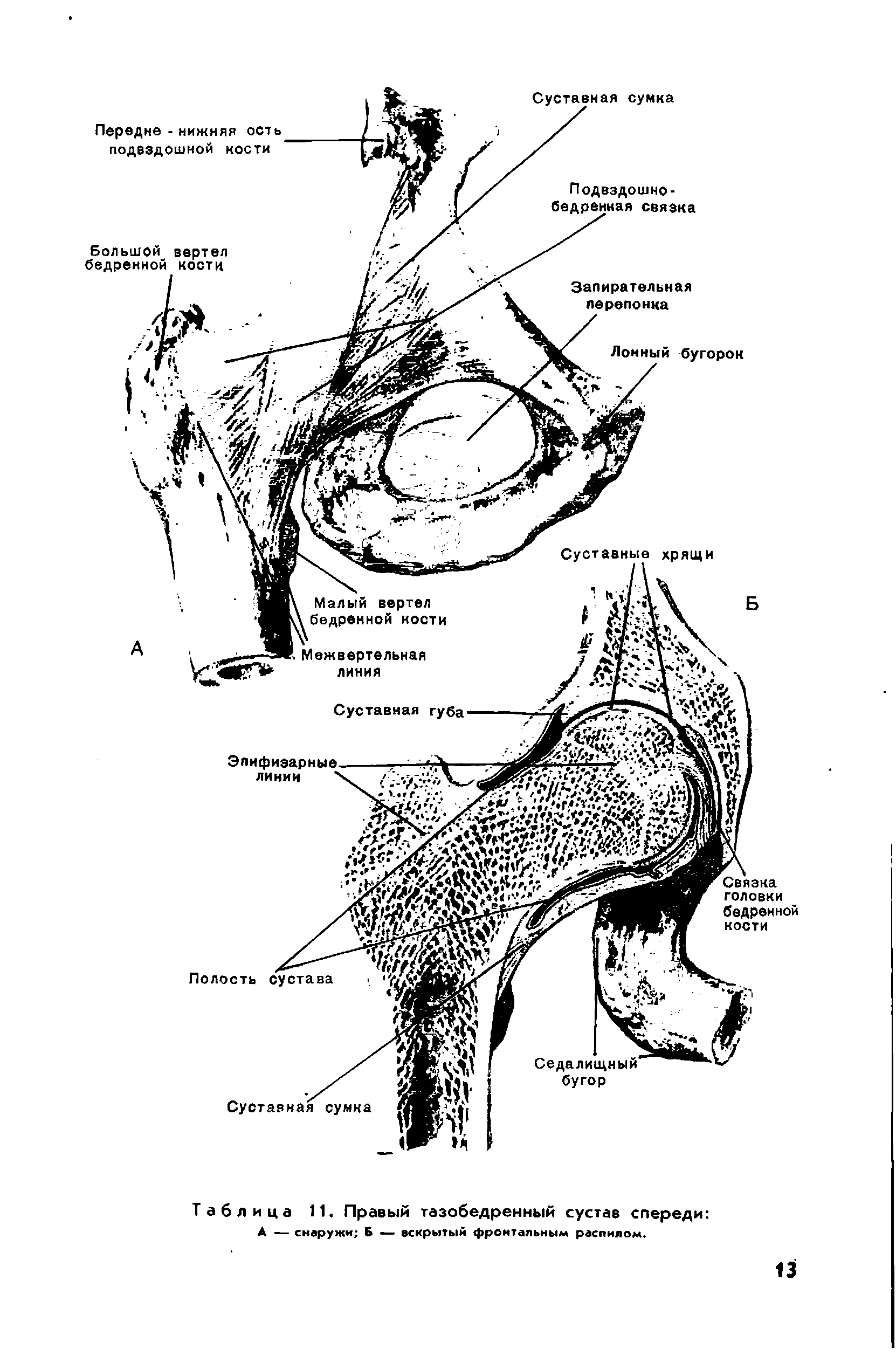Таблица 11. Правый тазобедренный сустав спереди А — снаружи Б — вскрытый фронтальным распилом.