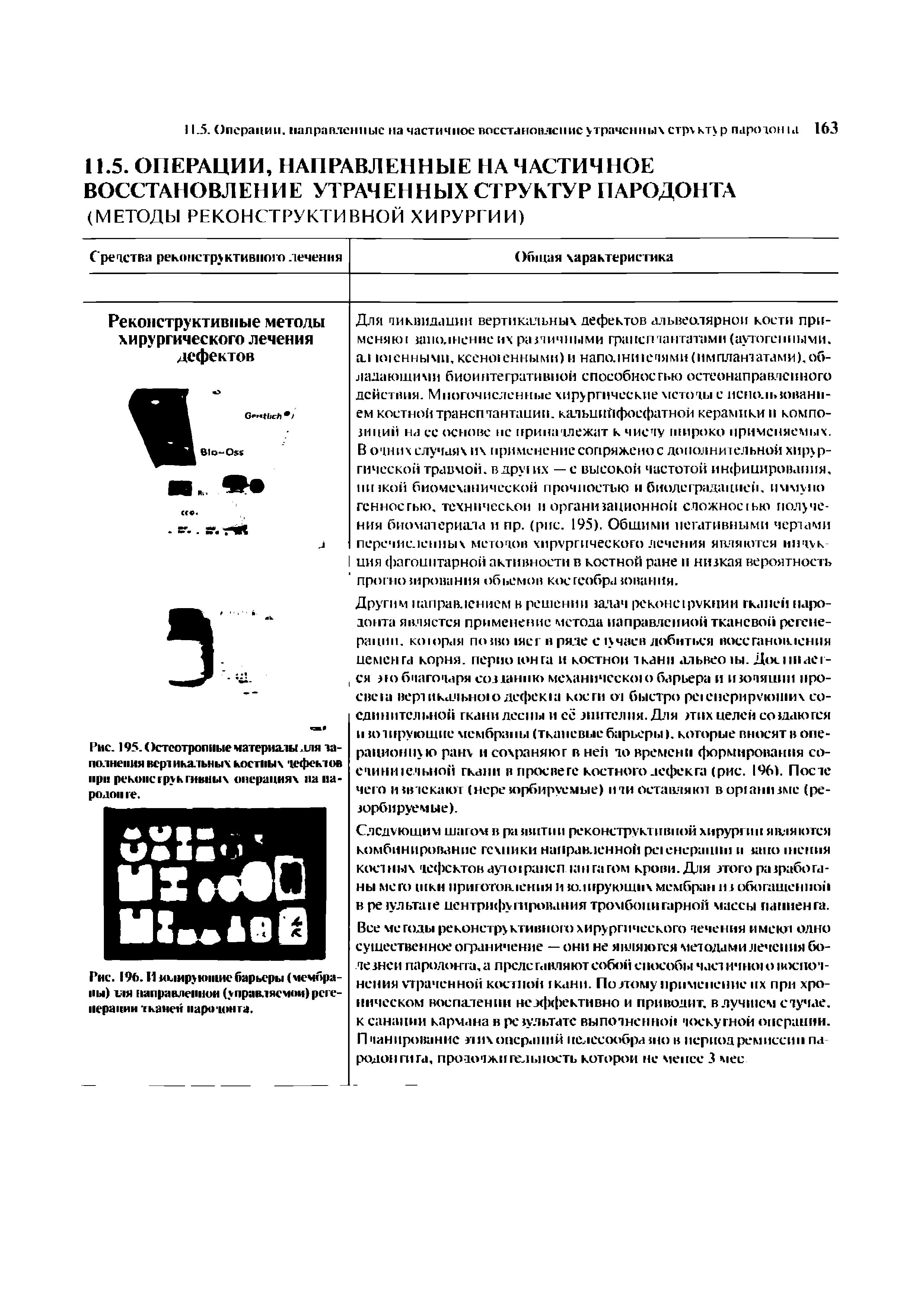 Рис. 196. И ммируниние барьеры (мембраны) тля направленной (управляемой) регенерации тканей пара лонга.