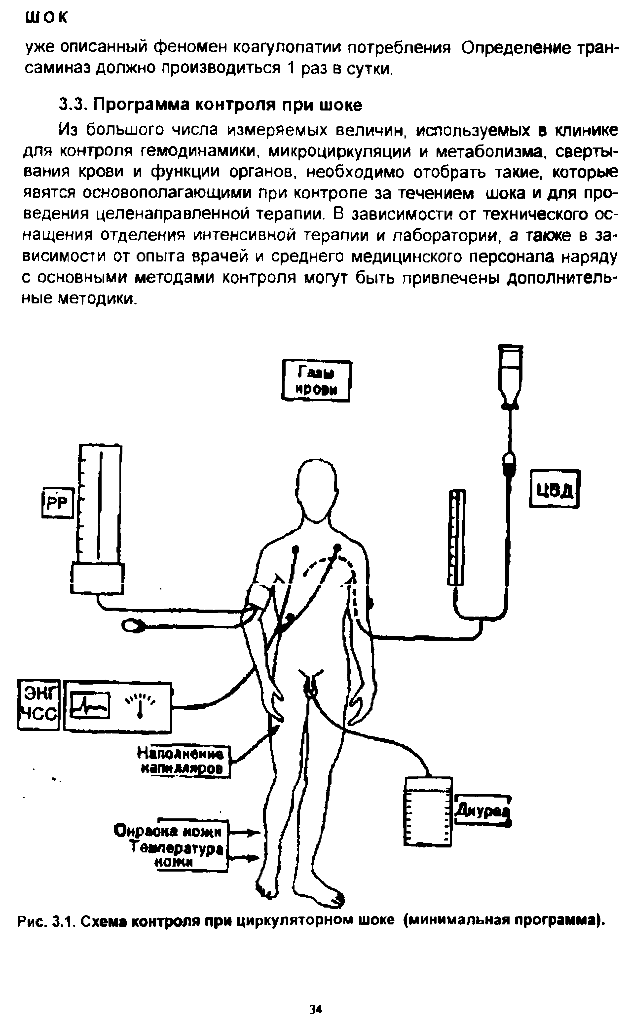 Рис. 3.1. Схема контроля при циркуляторном шоке (минимальная программа).