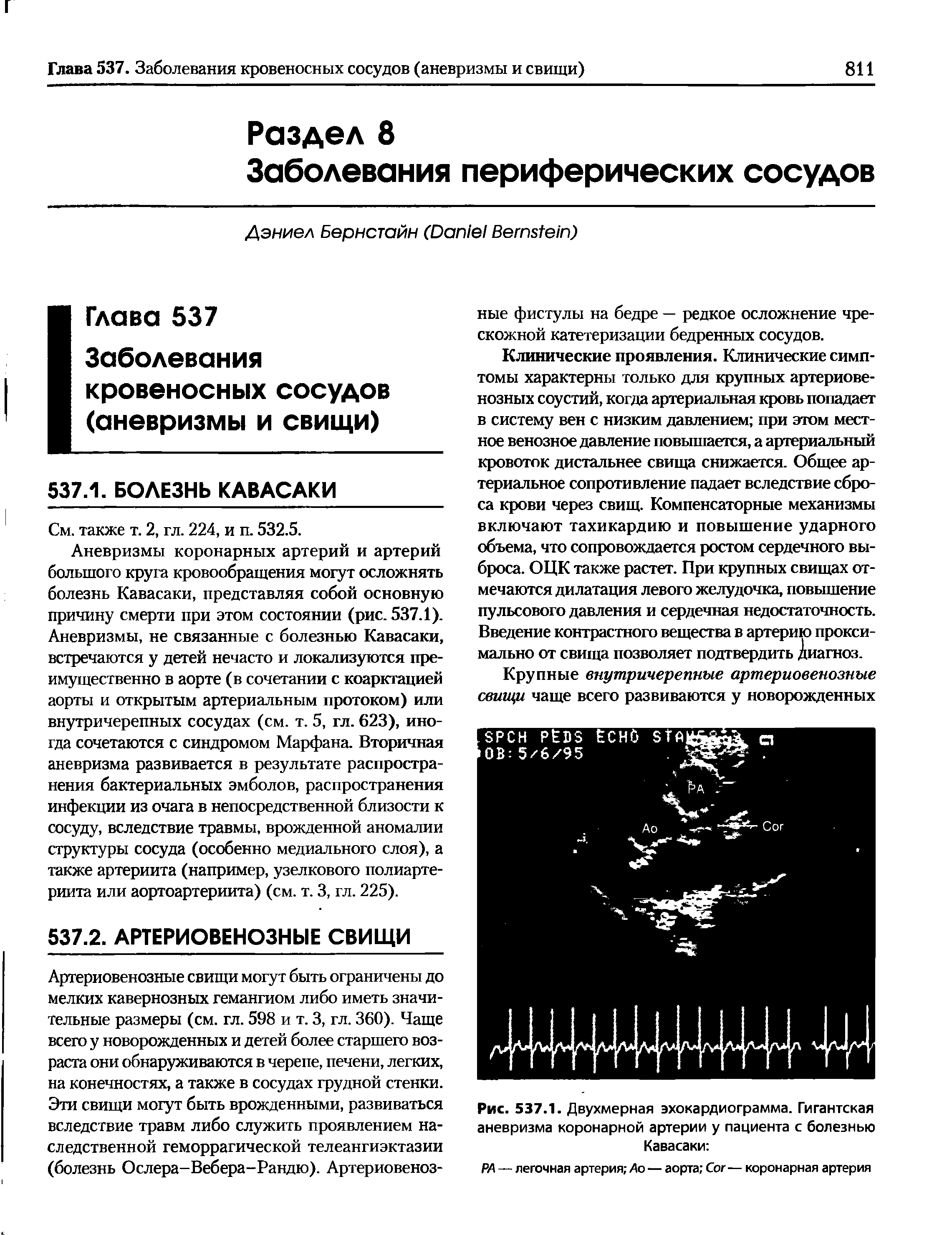 Рис. 537.1. Двухмерная эхокардиограмма. Гигантская аневризма коронарной артерии у пациента с болезнью Кавасаки ...