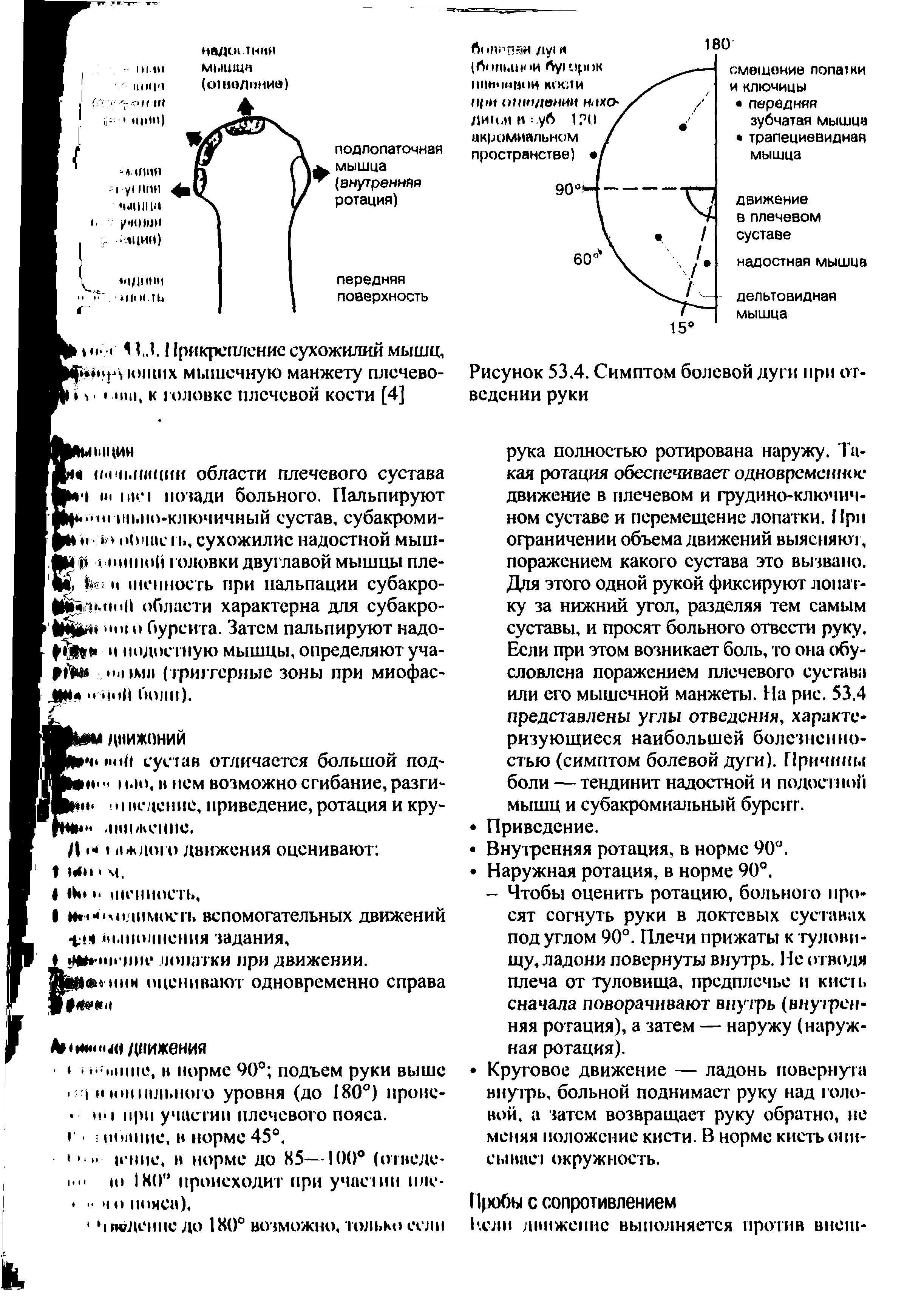 Рисунок 53.4. Симптом болевой дуги при ог ведении руки...