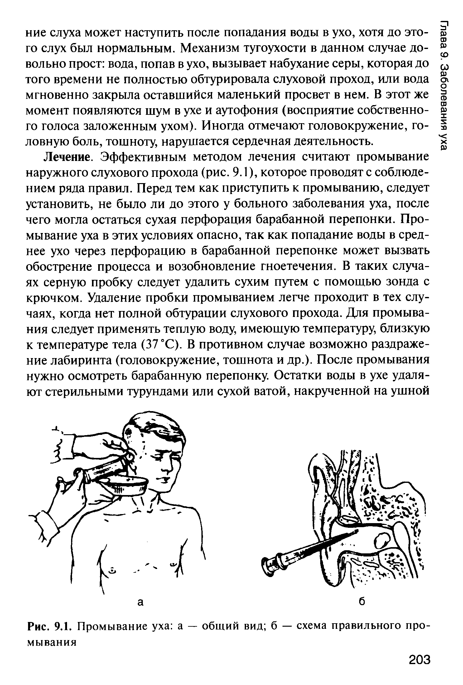 Как промывать уши человеку