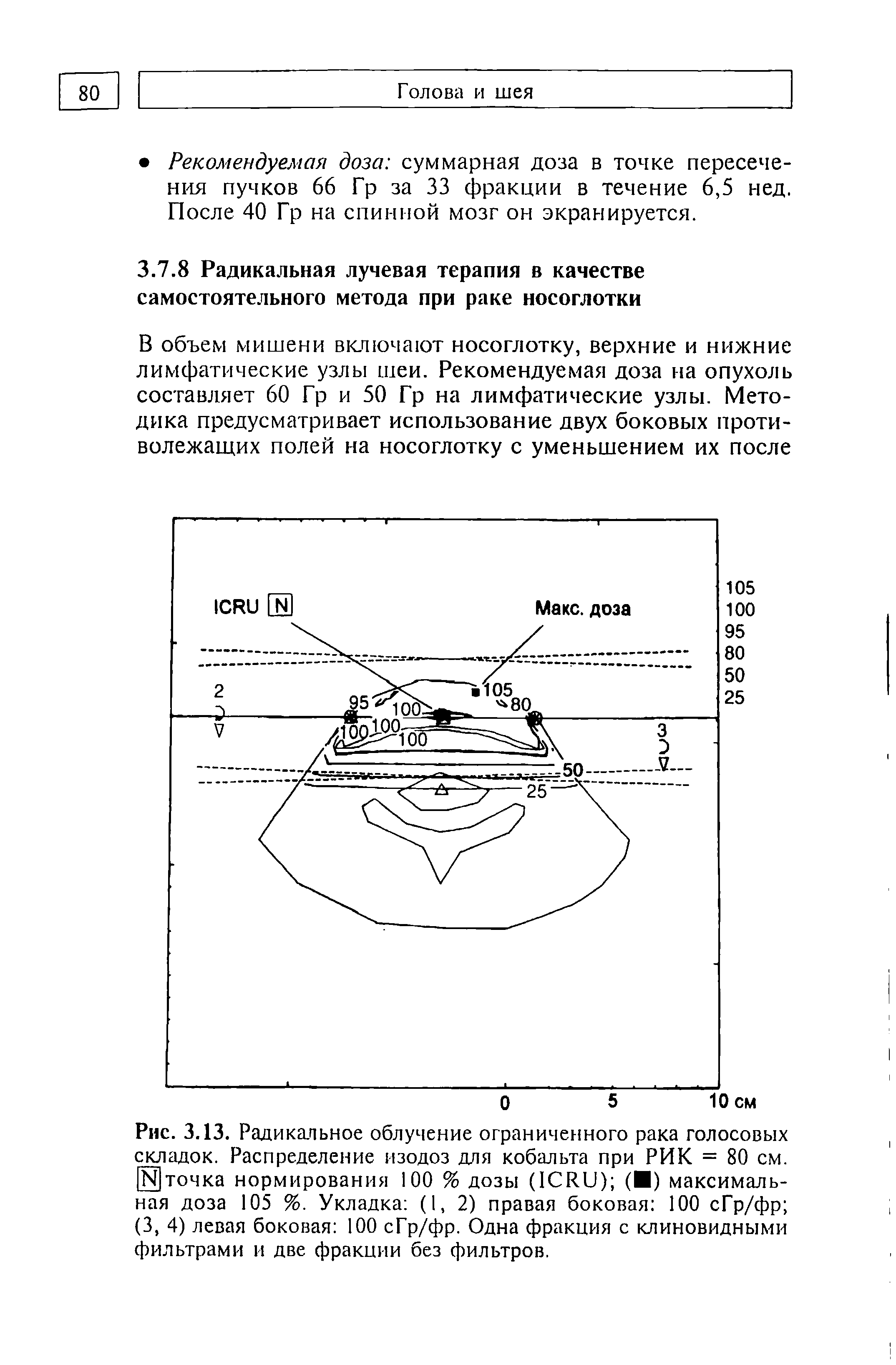 Рис. 3.13. Радикальное облучение ограниченного рака голосовых складок. Распределение изодоз для кобальта при РИК = 80 см. [ точка нормирования 100 % дозы (1CRU) ( ) максимальная доза 105 %. Укладка (1,2) правая боковая 100 сГр/фр (3, 4) левая боковая 100 сГр/фр. Одна фракция с клиновидными фильтрами и две фракции без фильтров.