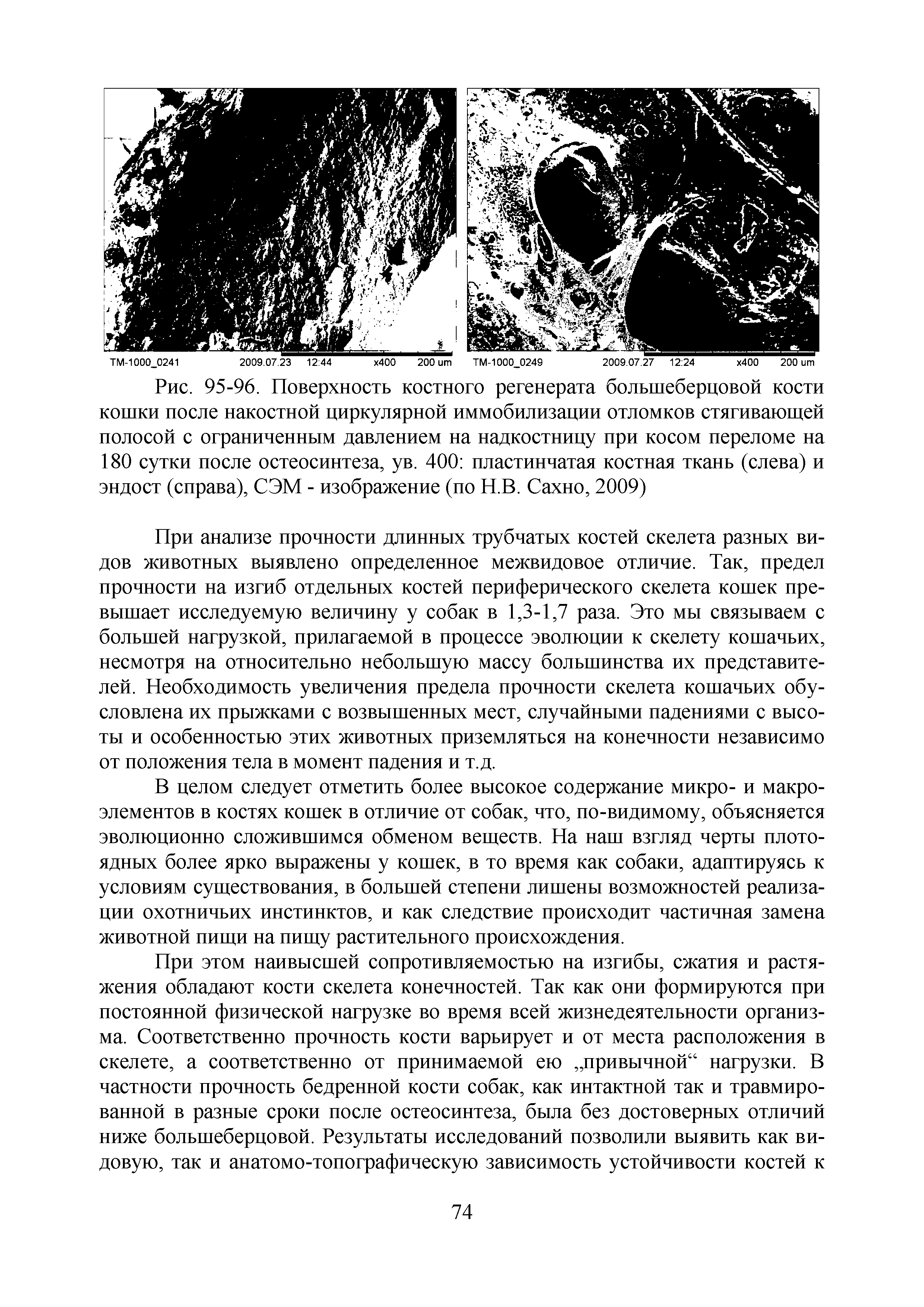 Рис. 95-96. Поверхность костного регенерата большеберцовой кости кошки после накостной циркулярной иммобилизации отломков стягивающей полосой с ограниченным давлением на надкостницу при косом переломе на 180 сутки после остеосинтеза, ув. 400 пластинчатая костная ткань (слева) и эндост (справа), СЭМ - изображение (по Н.В. Сахно, 2009)...