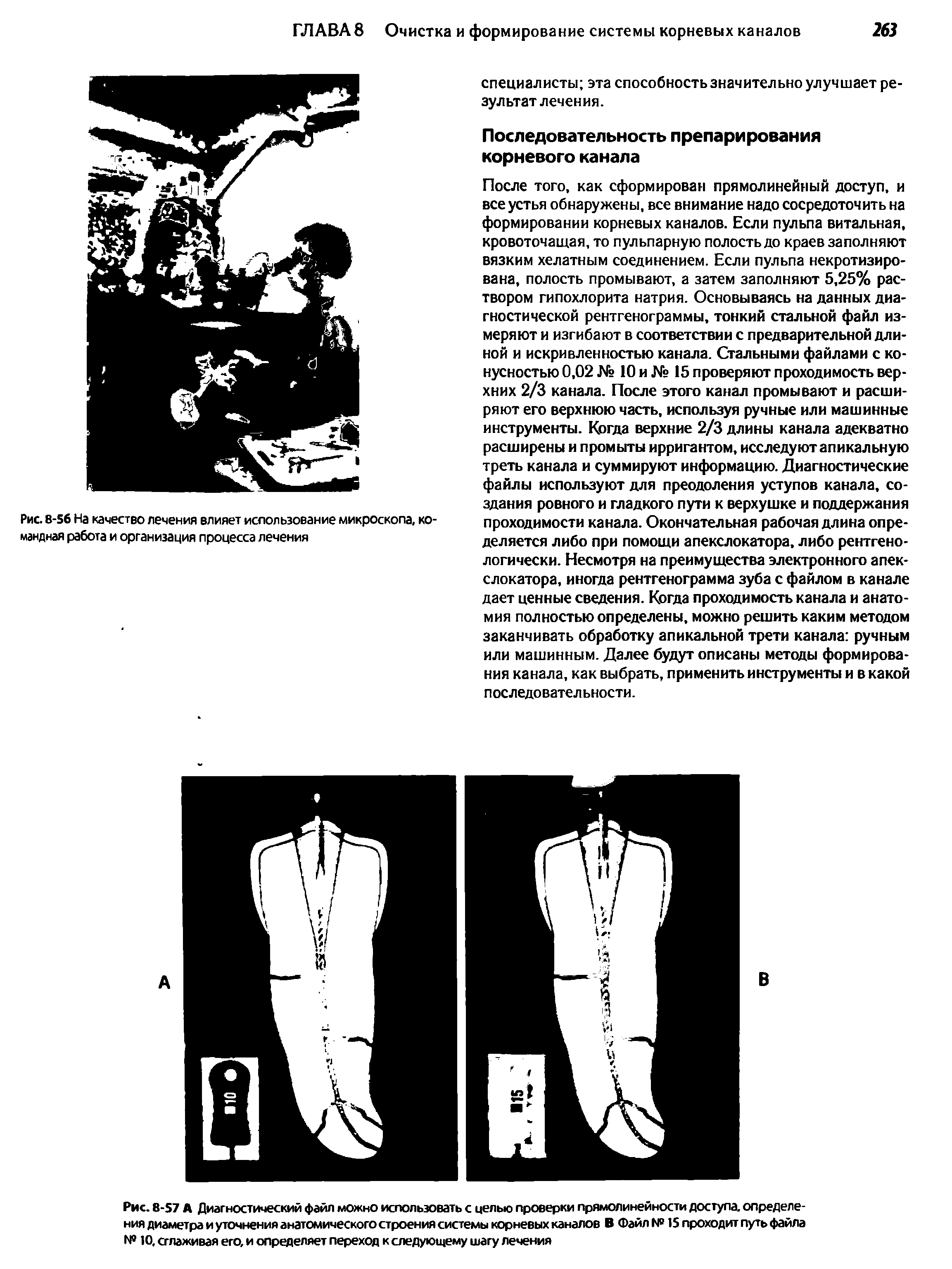 Рис. 8-57 А Диагностический файл можно использовать с целью проверки прямолинейности доступа, определения диаметра и уточнения анатомического строения системы корневых каналов В Файл № 15 проходит путь файла № 10, сглаживая его, и определяет переход к следующему шагу лечения...