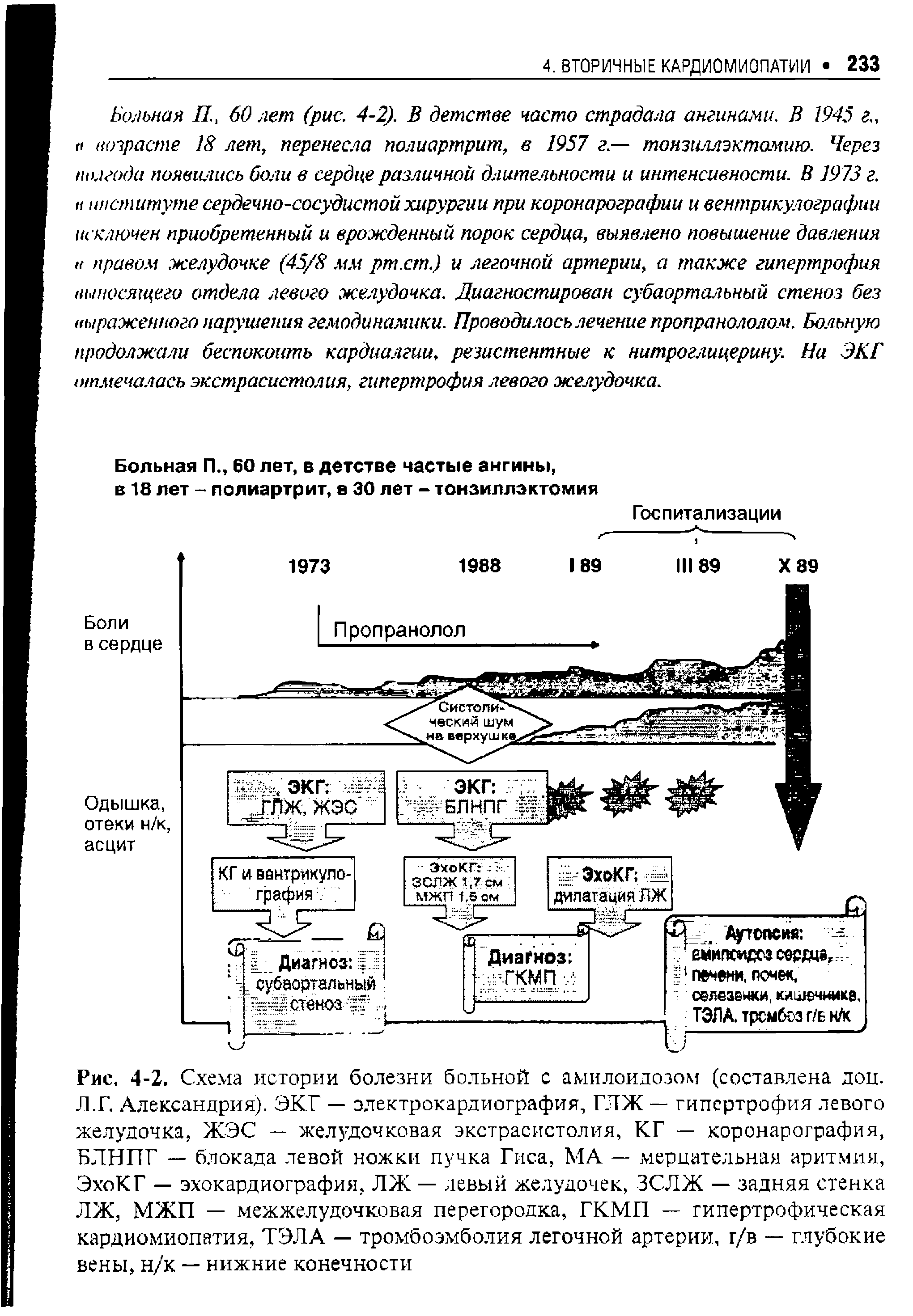 Рис. 4-2. Схема истории болезни больной с амилоидозом (составлена дон. Л.Г. Александрия). ЭКГ — электрокардиография, ГЛЖ — гипертрофия левого желудочка, ЖЭС — желудочковая экстрасистолия, КГ — коронарография, БЛНПГ — блокада левой ножки пучка Гиса, МА — мерцательная аритмия, ЭхоКГ — эхокардиография, ЛЖ — левый желудочек, ЗСЛЖ — задняя стенка ЛЖ, МЖП — межжелудочковая перегородка, ГКМП — гипертрофическая кардиомиопатия, ТЭЛА — тромбоэмболия легочной артерии, г/в — глубокие вены, н/к — нижние конечности...