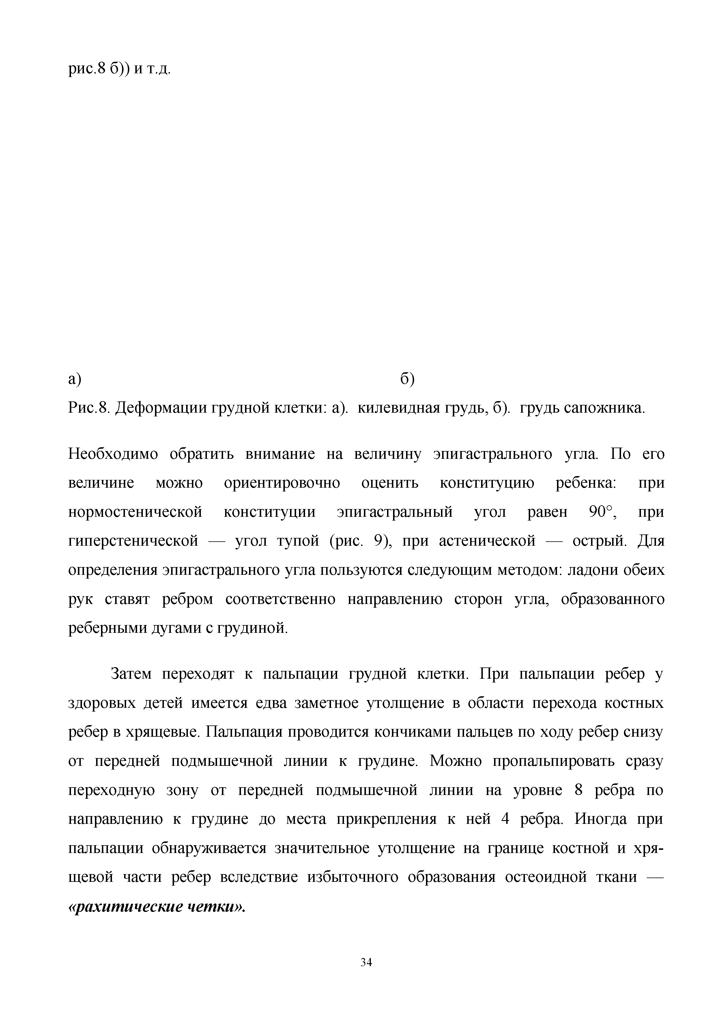 Рис.8. Деформации грудной клетки а), килевидная грудь, б), грудь сапожника.