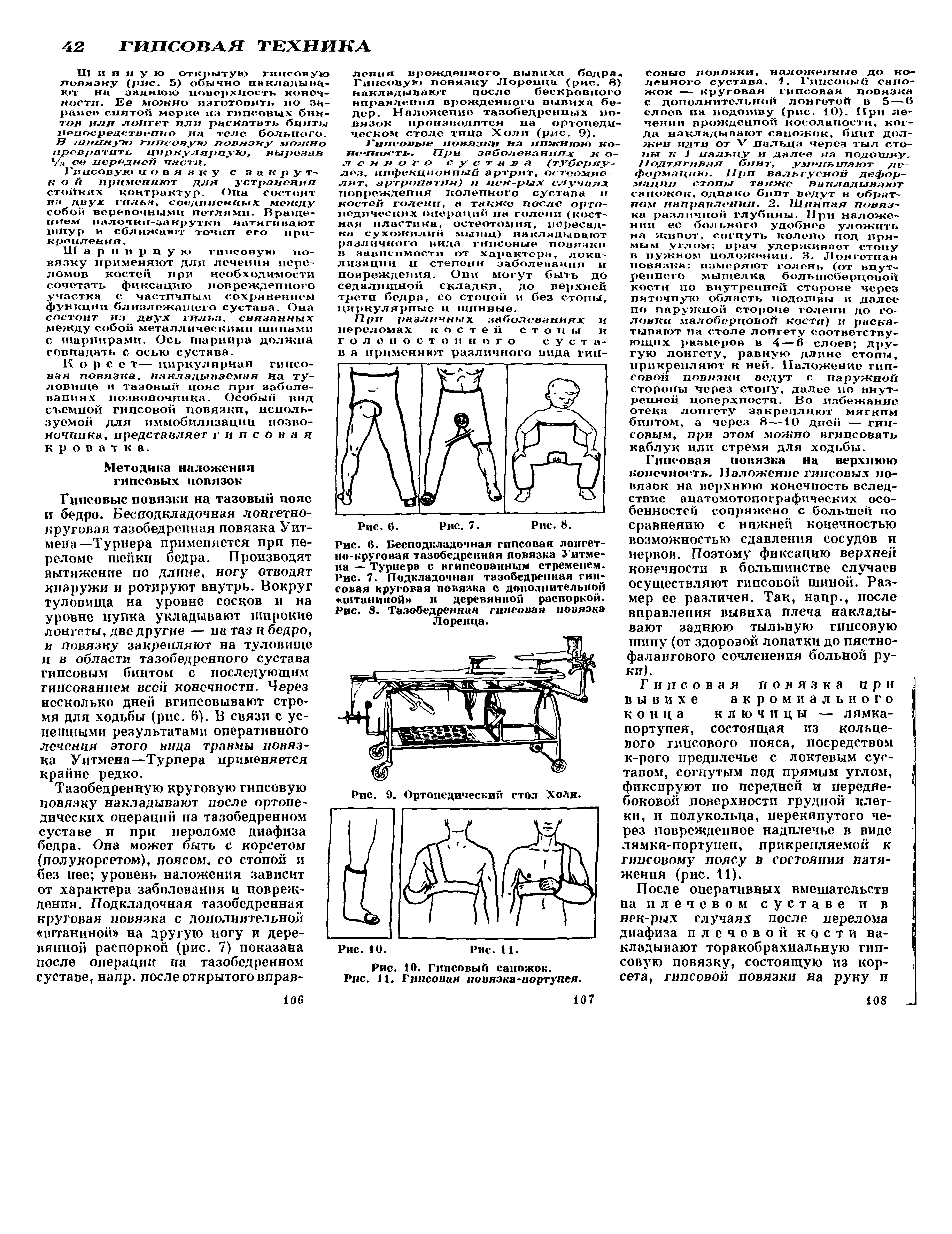 Рис. 6. Бесподкладочная гипсовая лопгет-но-круговая тазобедренная повязка Уитмена — Турнера с вгипсованным стременем. Рис. 7. Подкладочная тазобедренная гипсовая круговая повязка с дополнительной штаниной и деревянной распоркой. Рис. 8. Тазобедренная гипсовая повязка Лоренца.