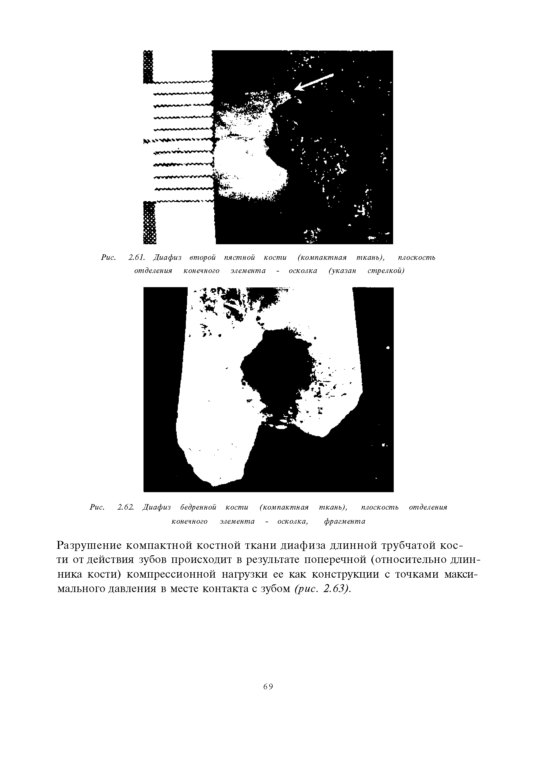 Рис. 2.62. Диафиз бедренной кости (компактная ткань), плоскость отделения...