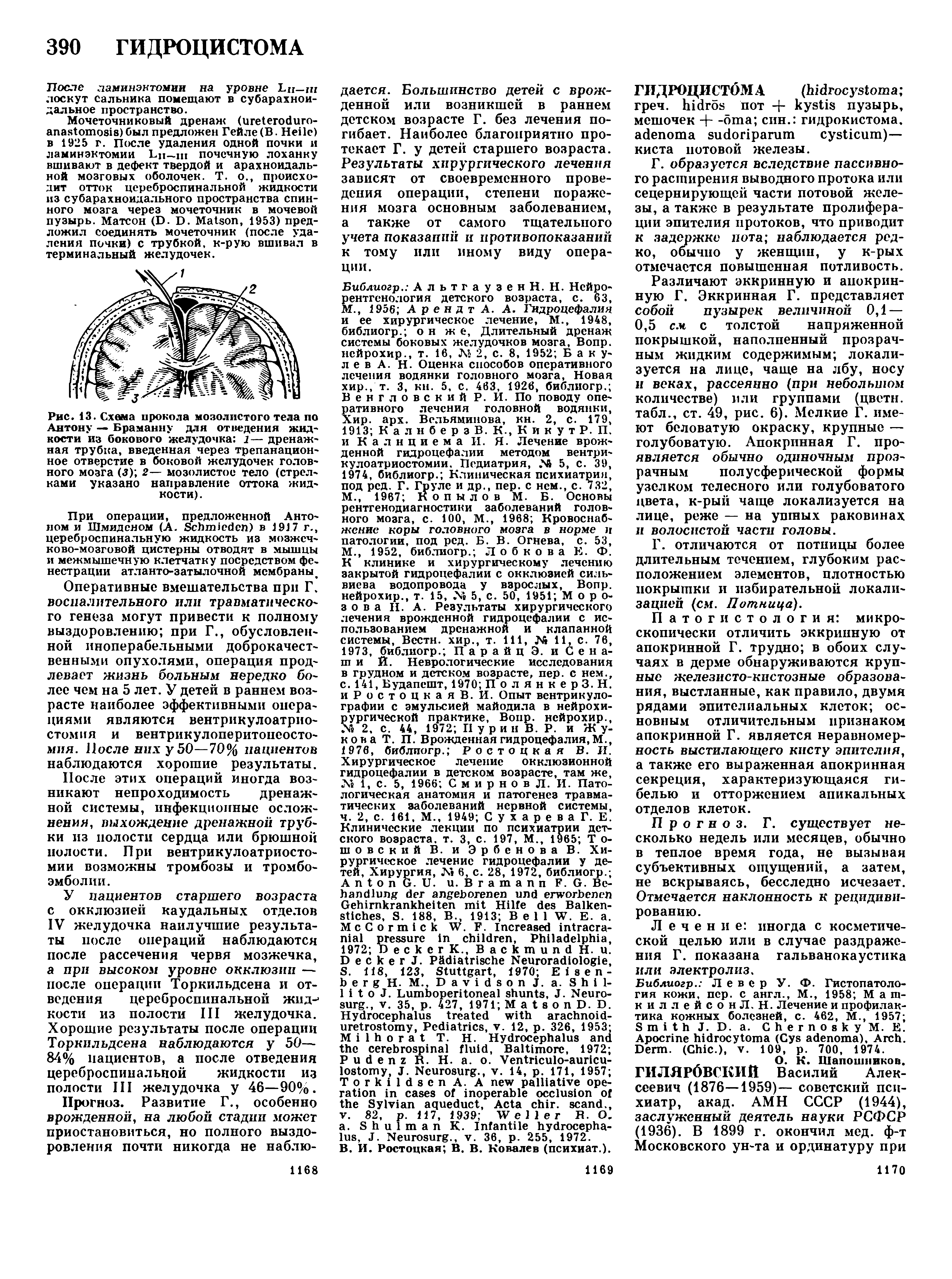 Рис. 13. Схема прокола мозолистого тела по Антону — Браманну для отведения жидкости из бокового желудочка 1— дренажная трубка, введенная через трепанационное отверстие в боковой желудочек головного мозга (3) 2— мозолистое тело (стрелками указано направление оттока жидкости).