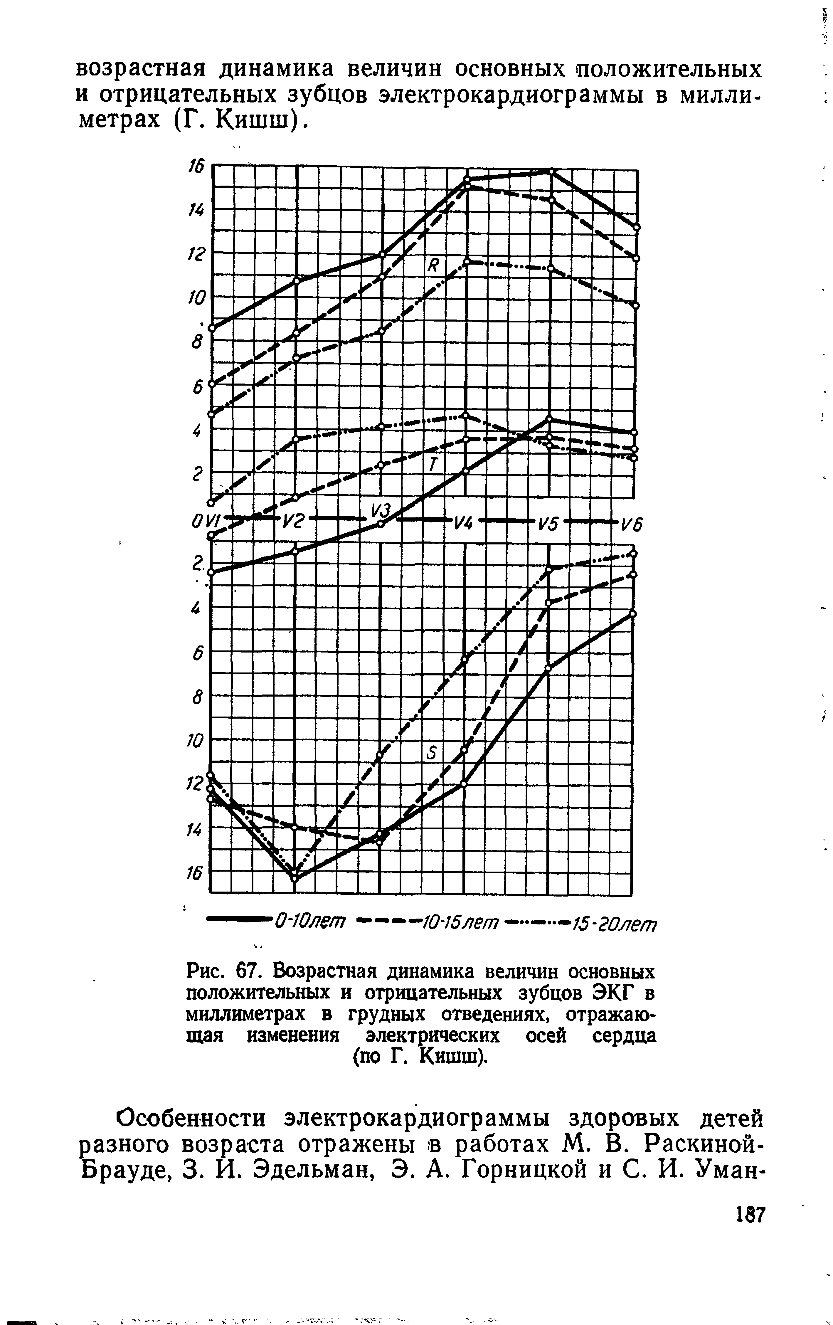 Рис. 67. Возрастная динамика величин основных положительных и отрицательных зубцов ЭКГ в миллиметрах в грудных отведениях, отражающая изменения электрических осей сердца (по Г. Кишш).