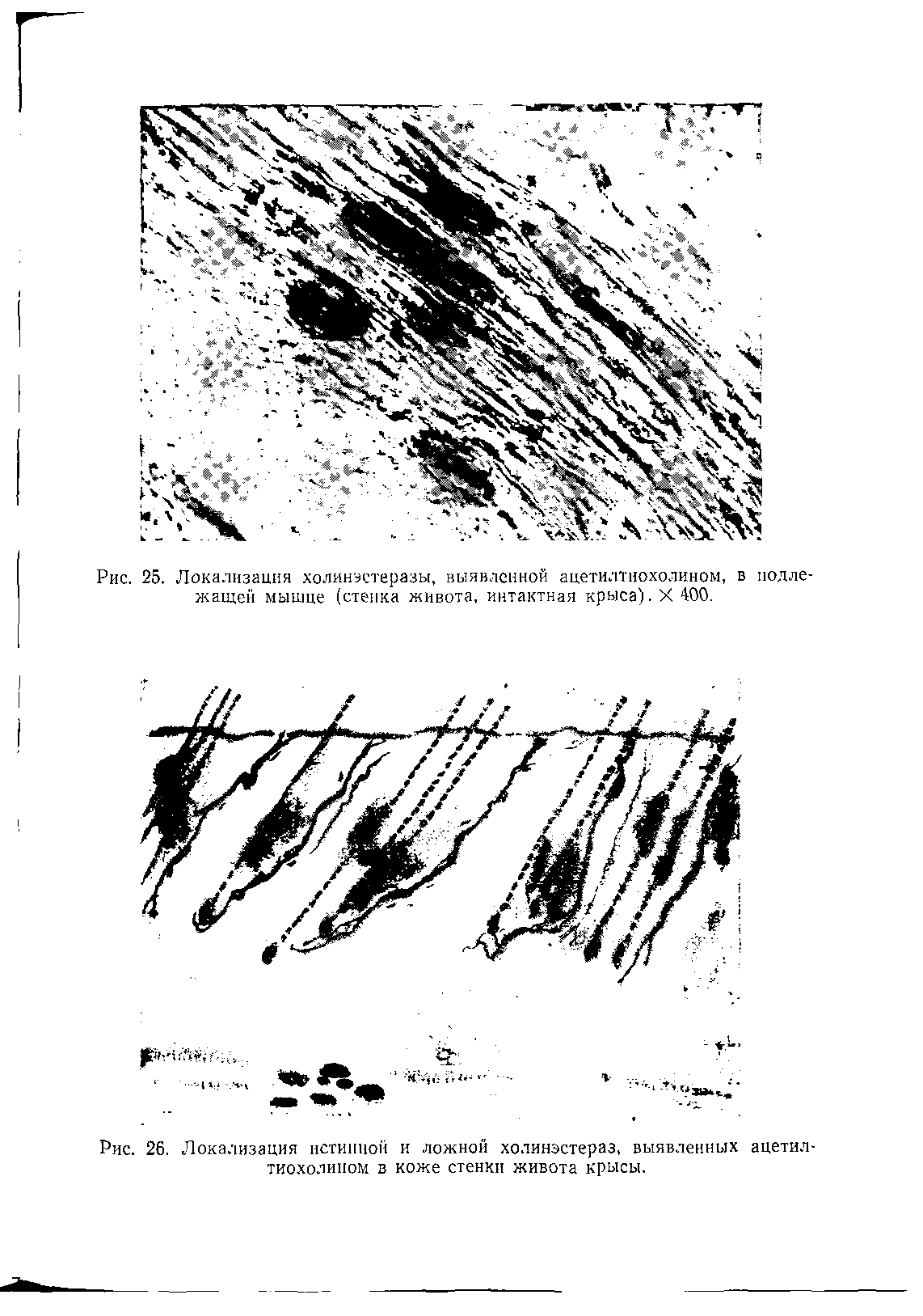 Рис. 26. Локализация истинной и ложной холинэстераз, выявленных ацетил-тиохолипом в коже стенки живота крысы.