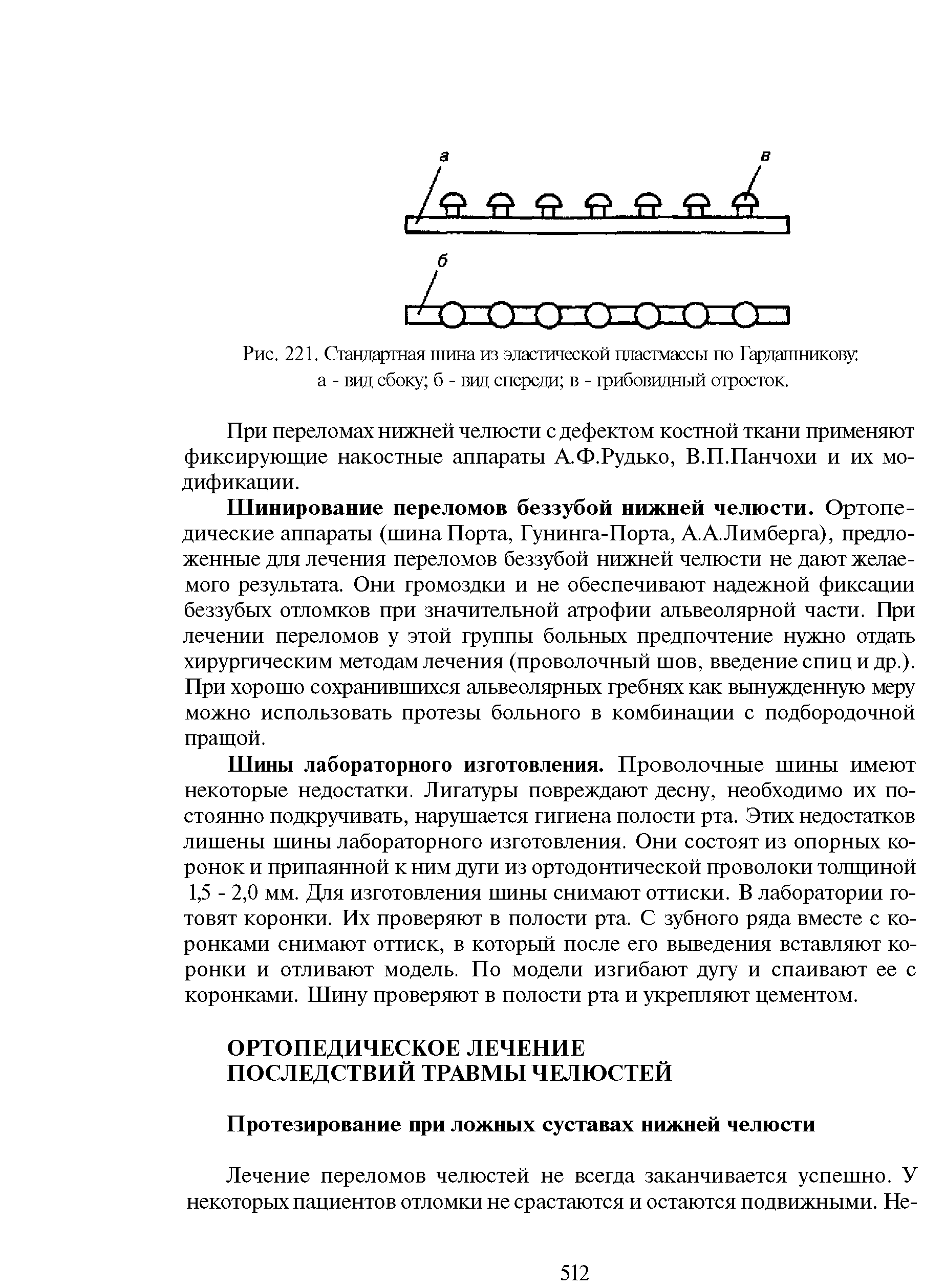 Рис. 221. Стандартная шина из эластической пластмассы по Гардашникову а - вид сбоку б - вид спереди в - грибовидный отросток.