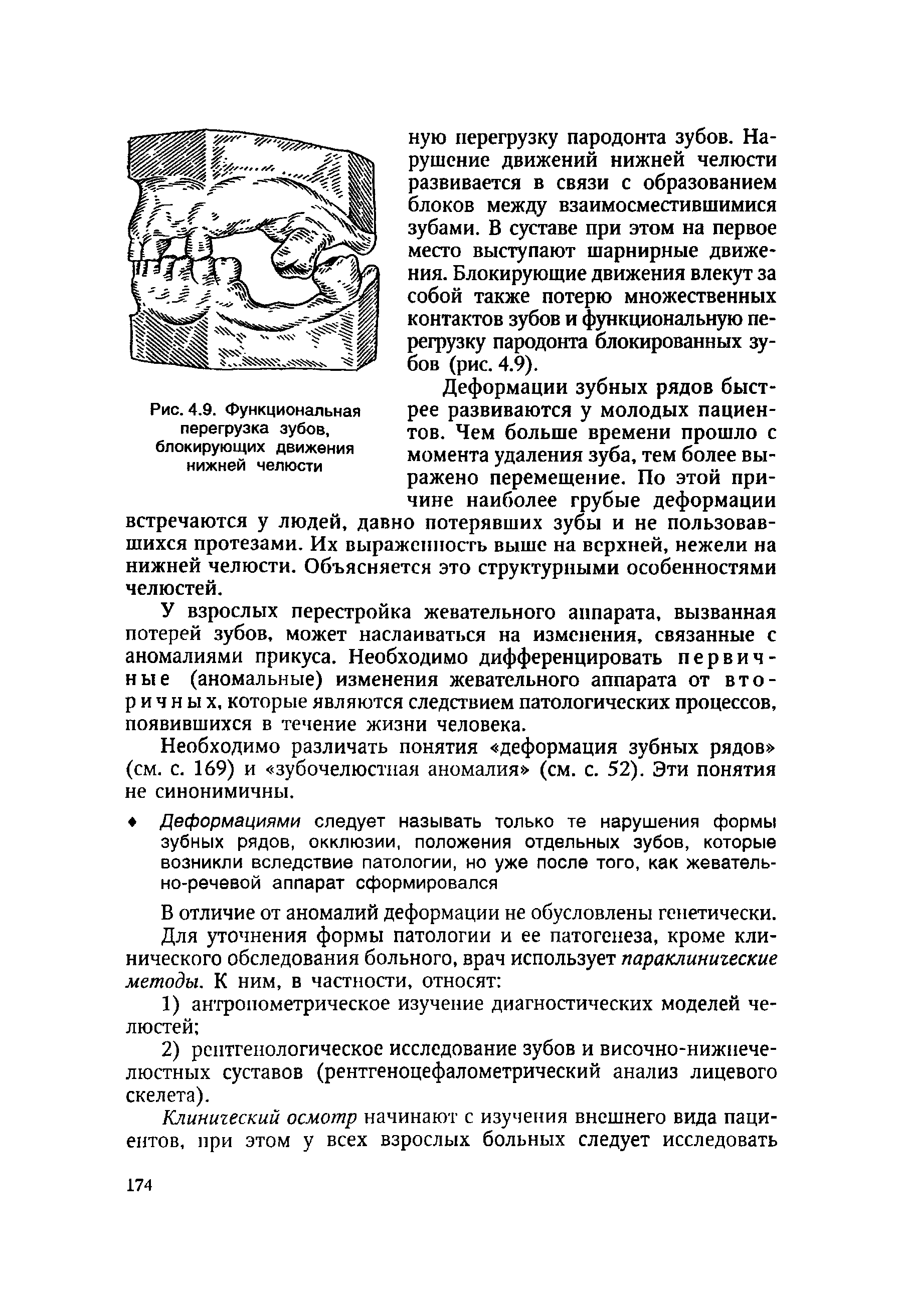 Рис. 4.9. Функциональная перегрузка зубов, блокирующих движения нижней челюсти рее развиваются у молодых пациентов. Чем больше времени прошло с момента удаления зуба, тем более выражено перемещение. По этой причине наиболее грубые деформации...