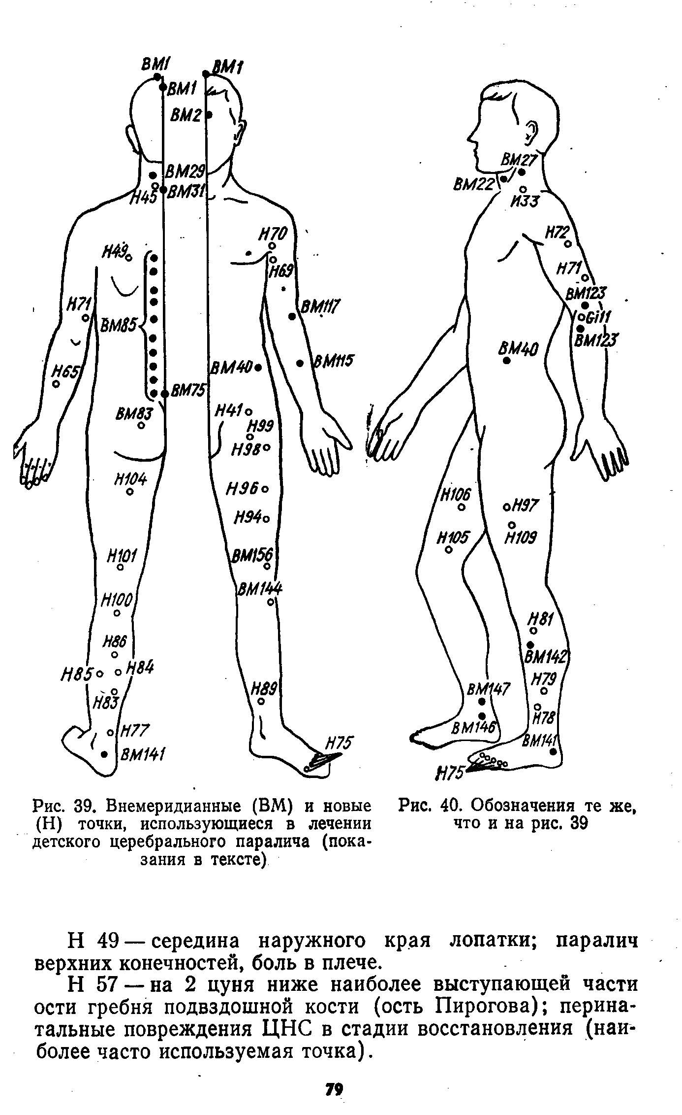 Рис. 39. Внемеридианные (ВМ) и новые (Н) точки, использующиеся в лечении детского церебрального паралича (показания в тексте)...