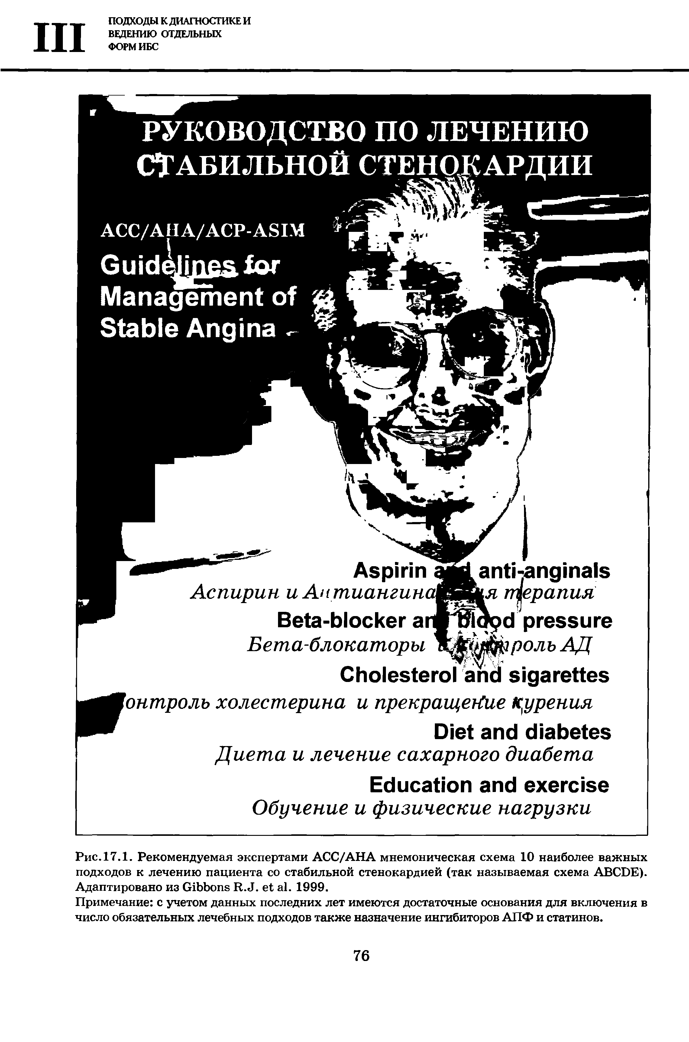 Рис.17.1. Рекомендуемая экспертами АСС/АНА мнемоническая схема 10 наиболее важных подходов к лечению пациента со стабильной стенокардией (так называемая схема ABCDE). Адаптировано из G R.J. . 1999.