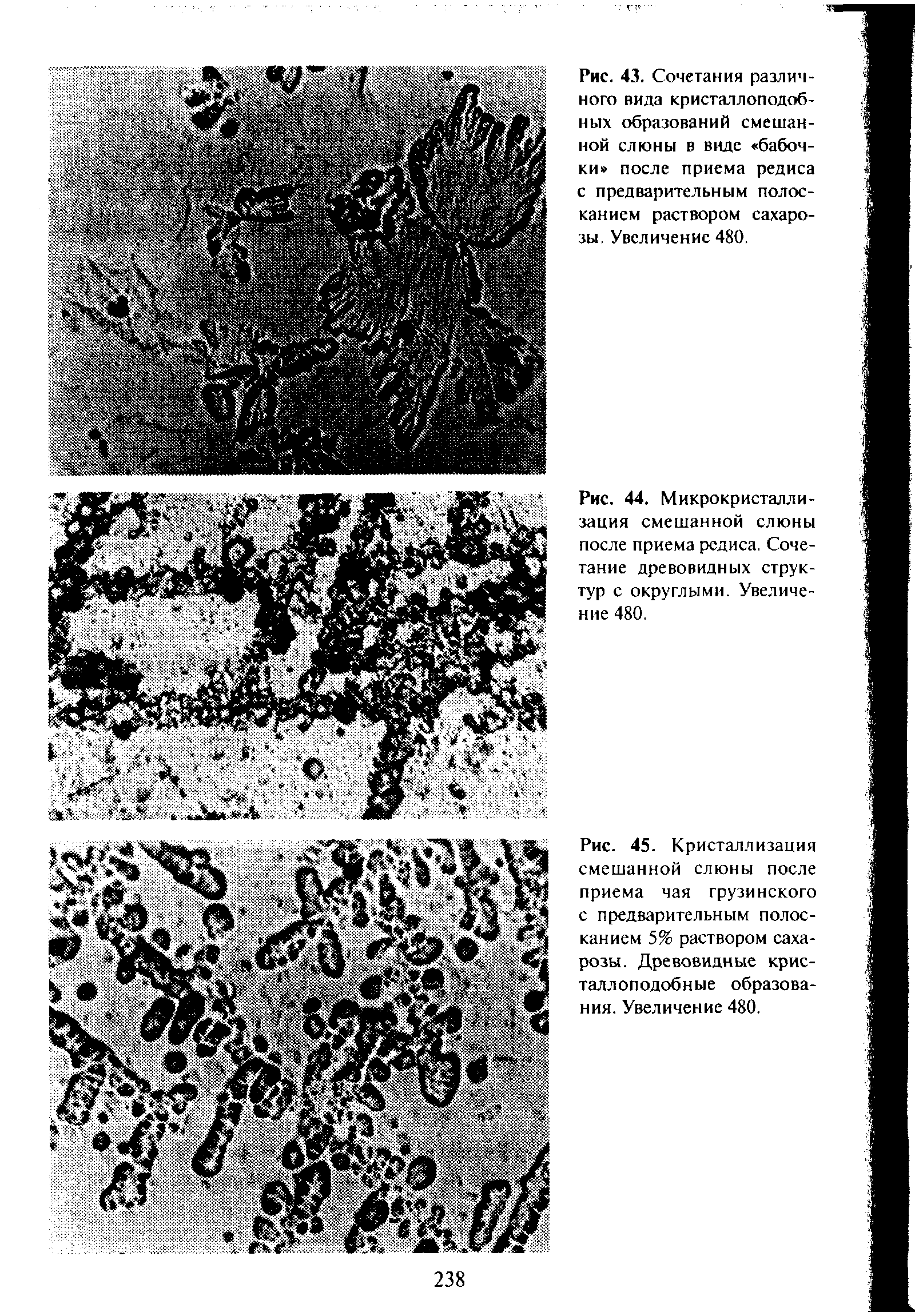 Рис. 44. Микрокристаллизация смешанной слюны после приема редиса. Сочетание древовидных структур с округлыми. Увеличение 480.