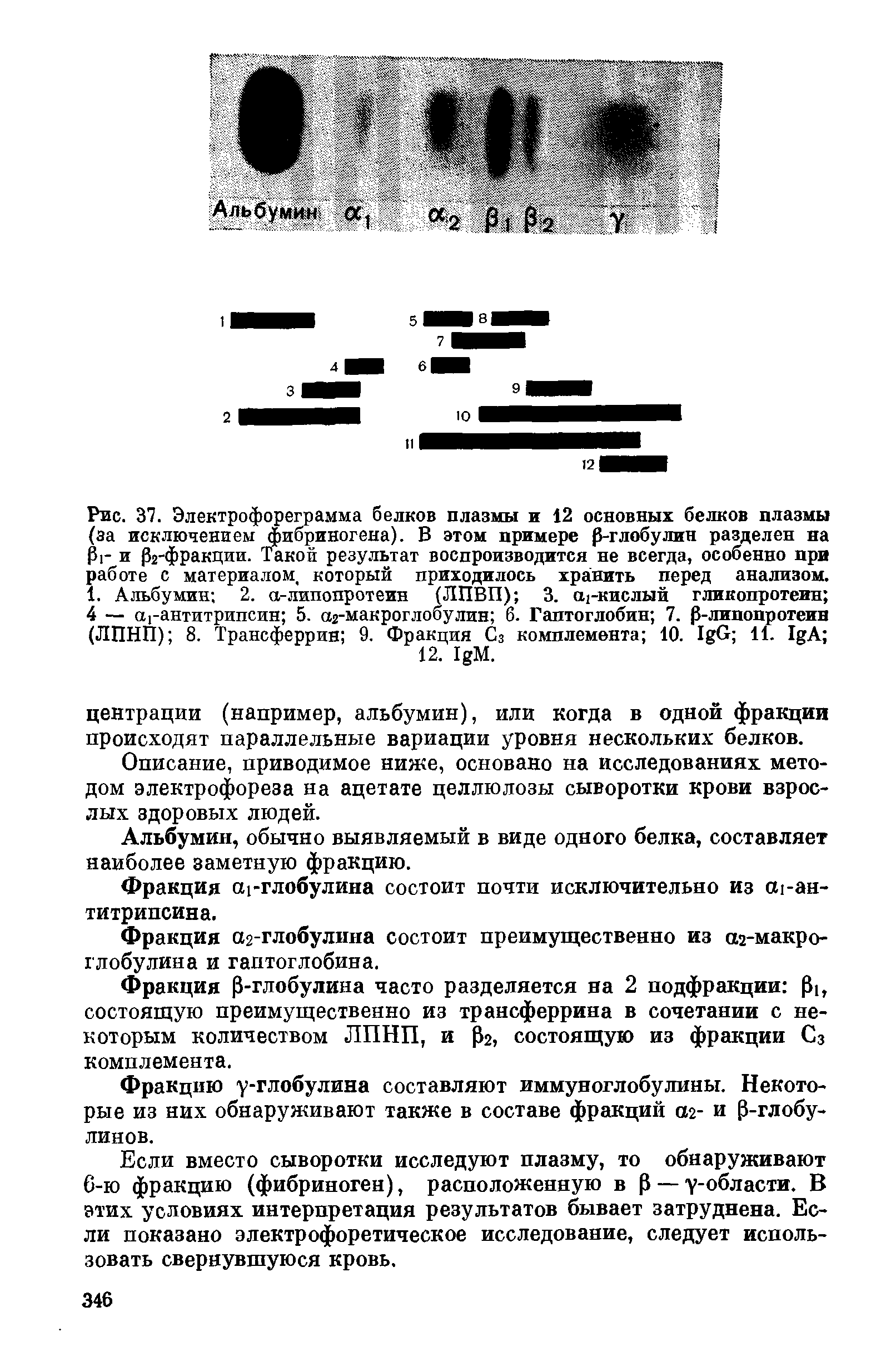 Рис. 37. Электрофореграмма белков плазмы и 12 основных белков плазмы (за исключением фибриногена). В этом примере -глобулин разделен на г и 02-фракции. Такой результат воспроизводится не всегда, особенно при работе с материалом, который приходилось хранить перед анализом. 1. Альбумин 2. а-липопротеин (ЛПВП) 3. -кислый гликопротеин 4 — агантитрипсин 5. аг-макроглобулин 6. Гаптоглобин 7. Р-липопротеин (ЛПНП) 8. Трансферрин 9. Фракция Сз комплемента 10. I G 11. I A ...