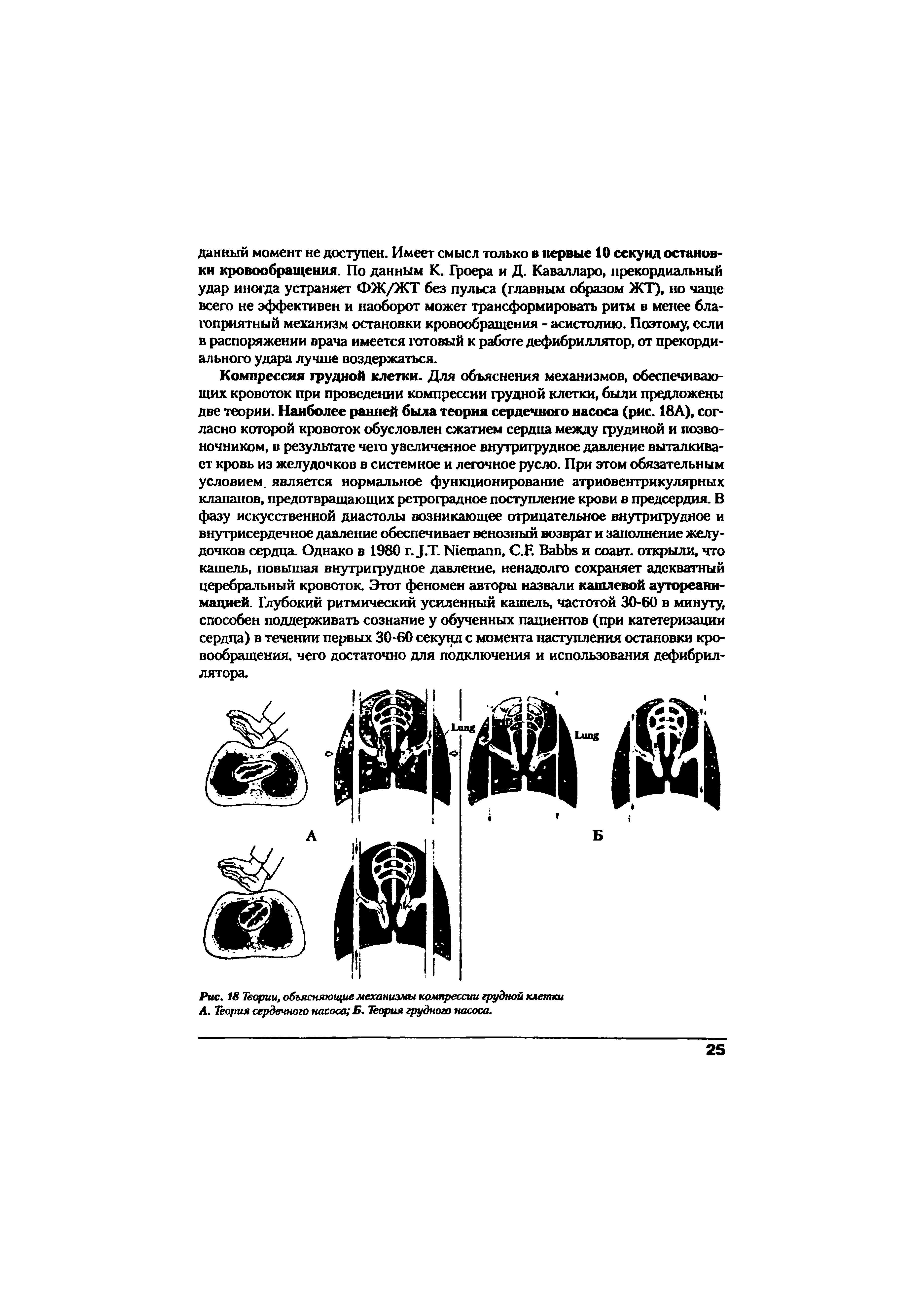 Рис. 18 Теории, объясняющие механизмы компрессии грудной клетки А. Теория сердечного насоса Б. Теория грудного насоса.
