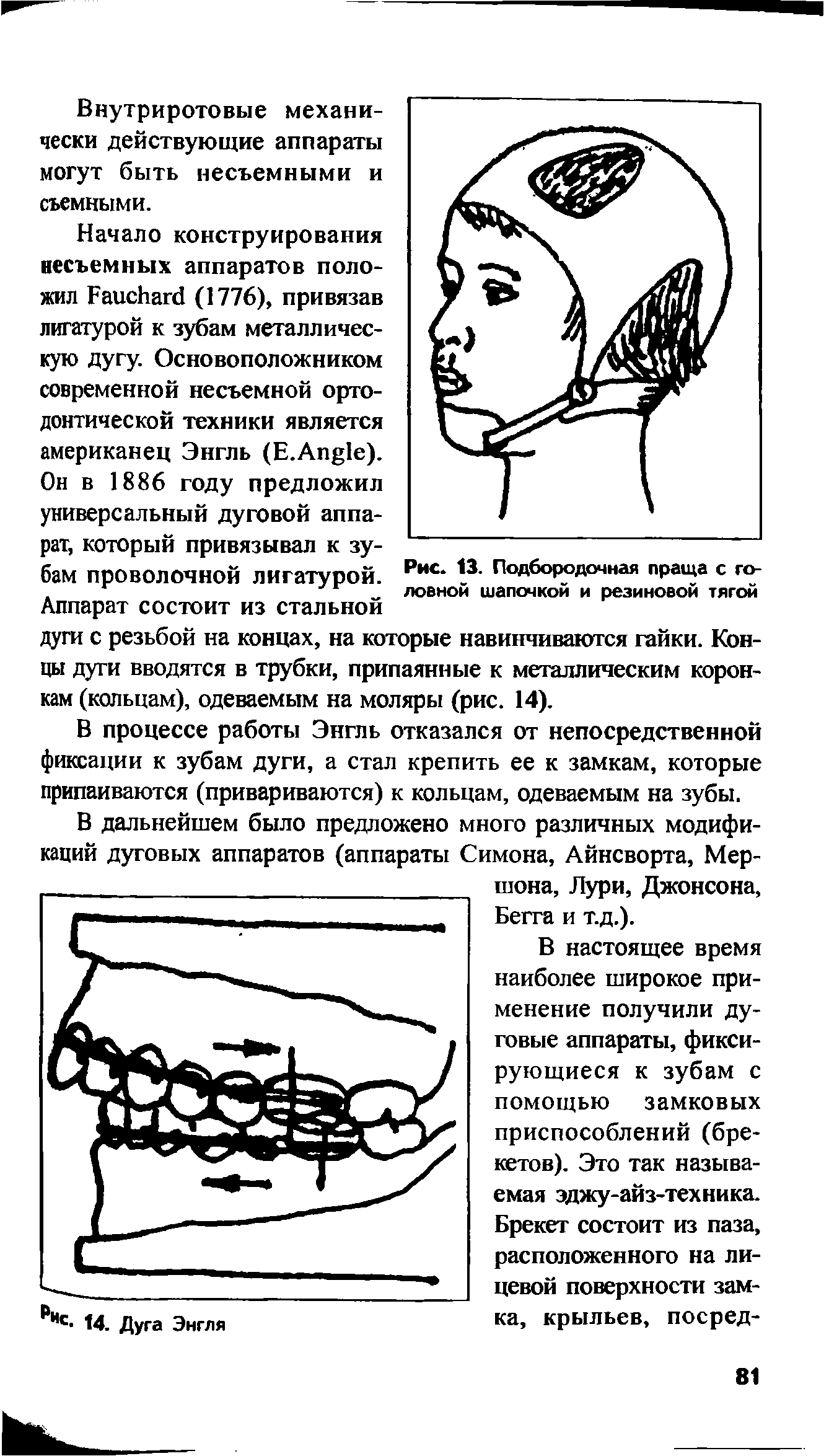 Рис. 13. Подбородочная праща с головной шапочкой и резиновой тягой...