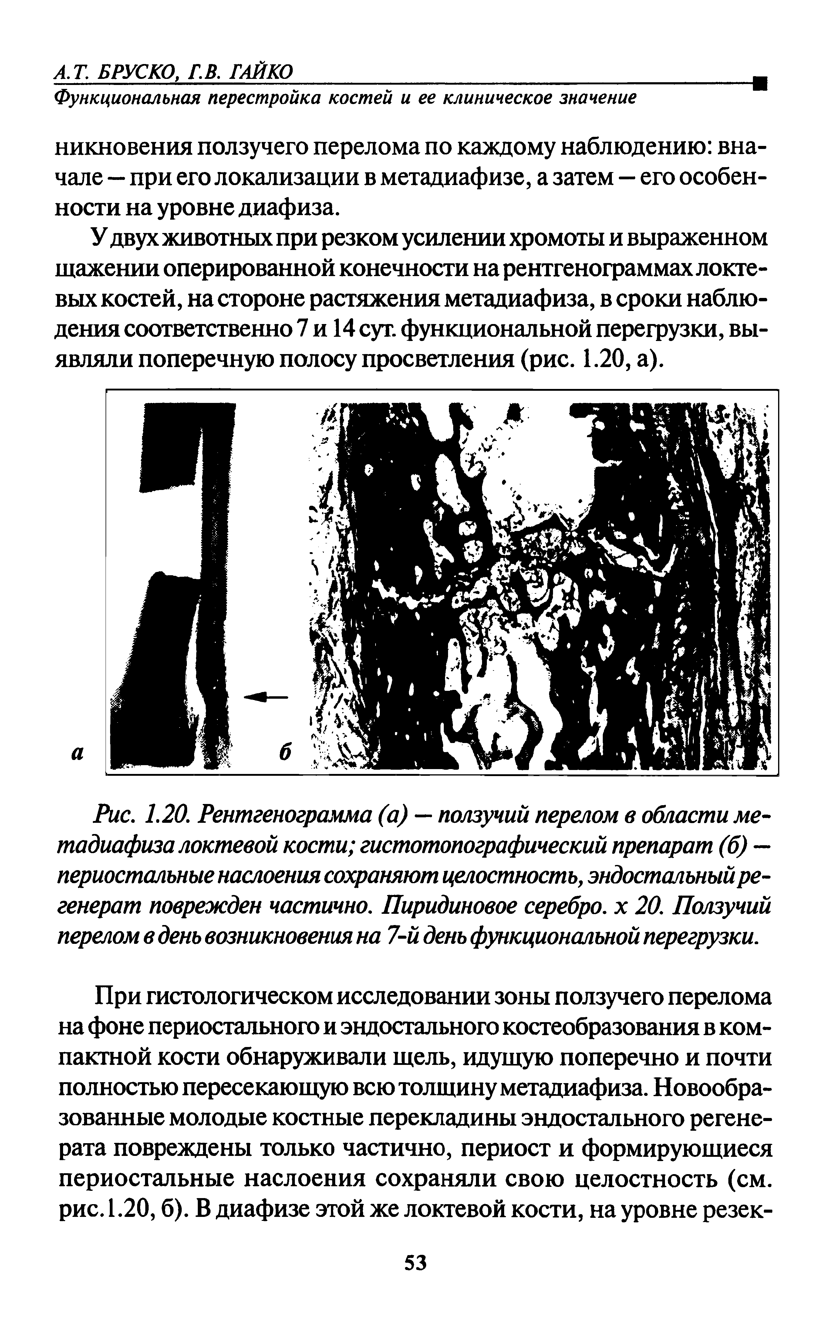 Рис. 1.20. Рентгенограмма (а) — ползучий перелом в области метадиафиза локтевой кости гистотопографический препарат (б) — периостальные наслоения сохраняют целостность, эндостальный регенерат поврежден частично. Пиридиновое серебро, х 20. Ползучий перелом в день возникновения на 7-й день функциональной перегрузки.