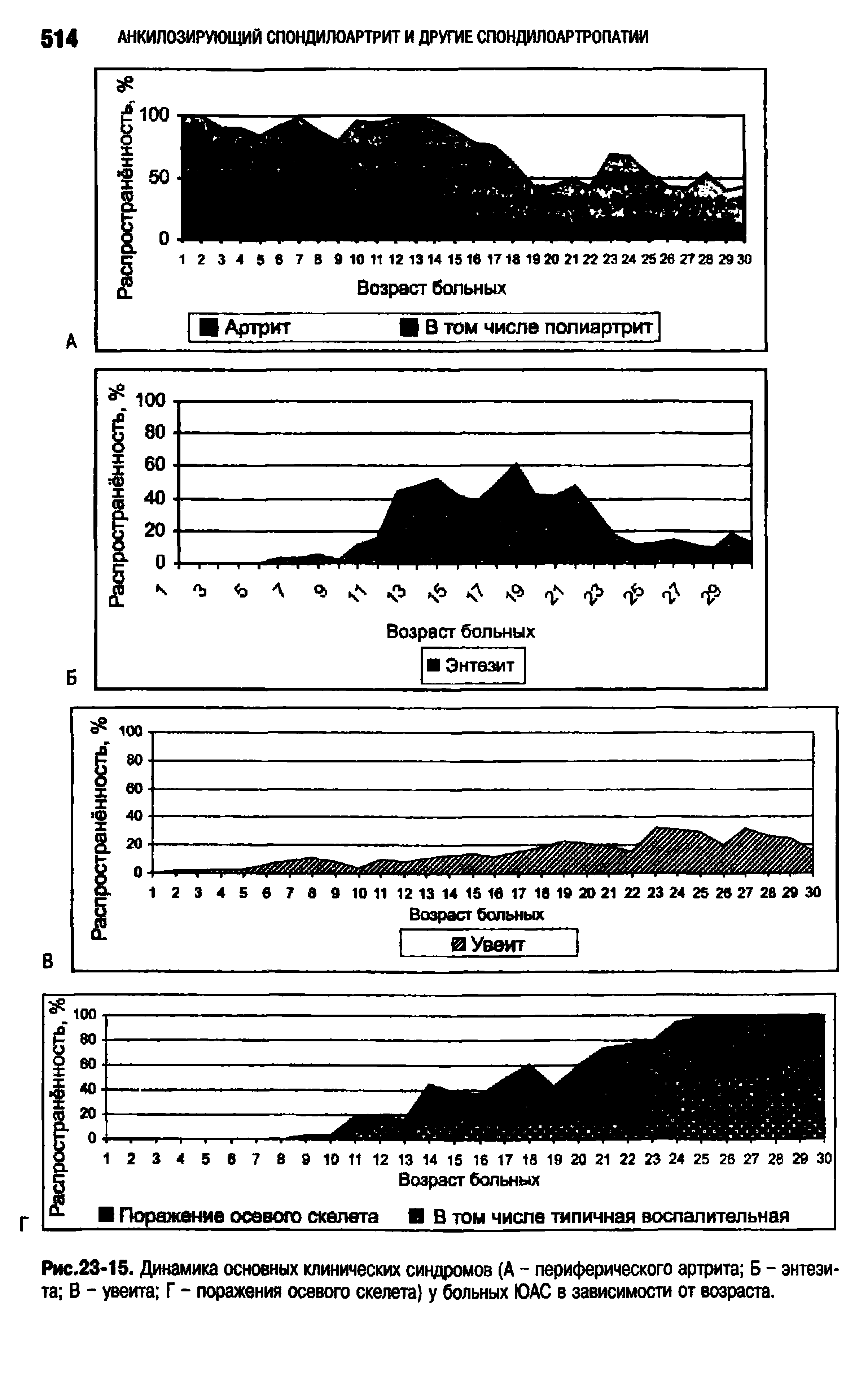 Рис.23-15. Динамика основных клинических синдромов (А - периферического артрита Б - энтези-та В - увеита Г - поражения осевого скелета) у больных ЮАС в зависимости от возраста.