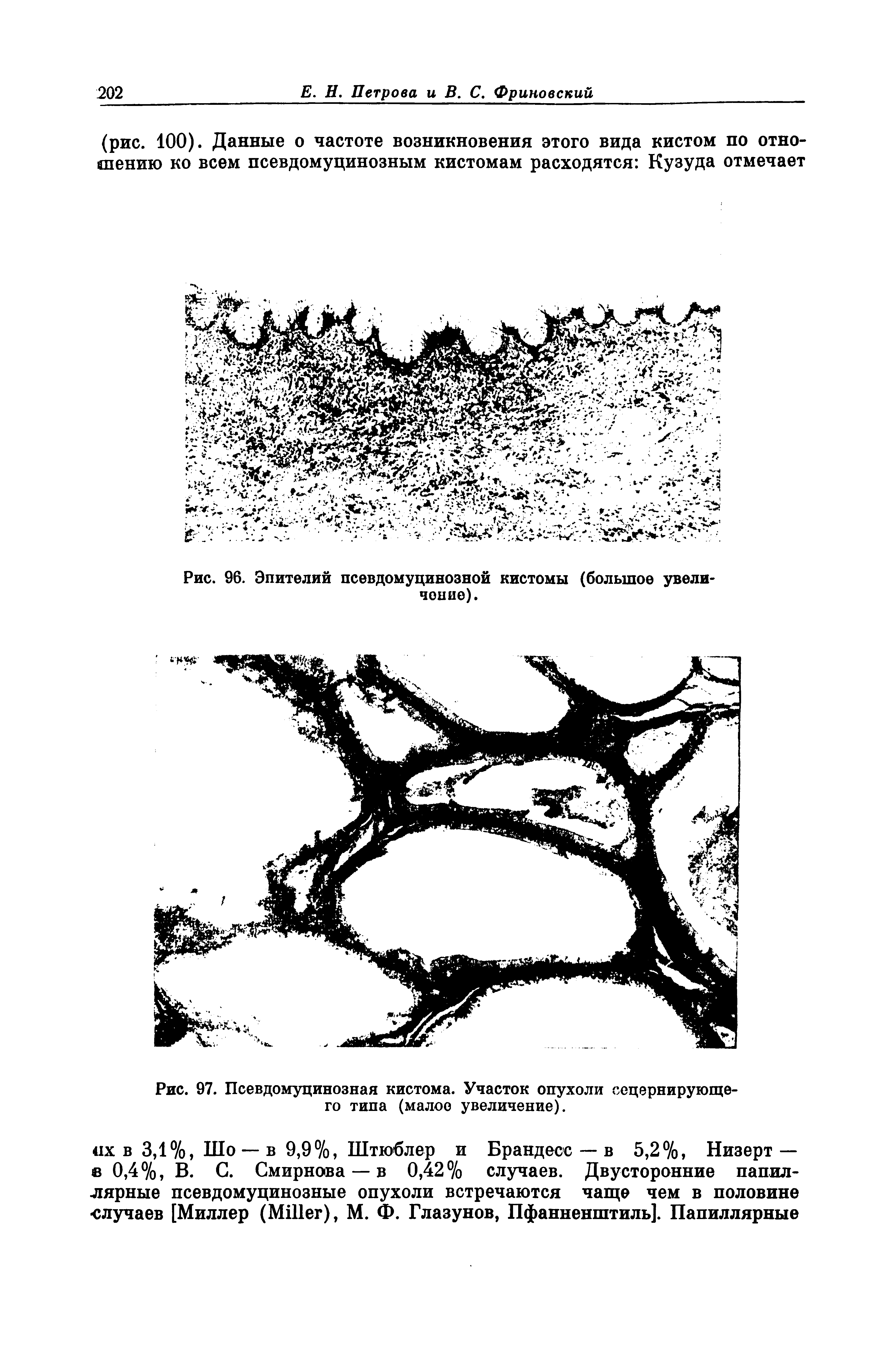 Рис. 96. Эпителий псевдомуцинозной кистомы (большое увели чоние).