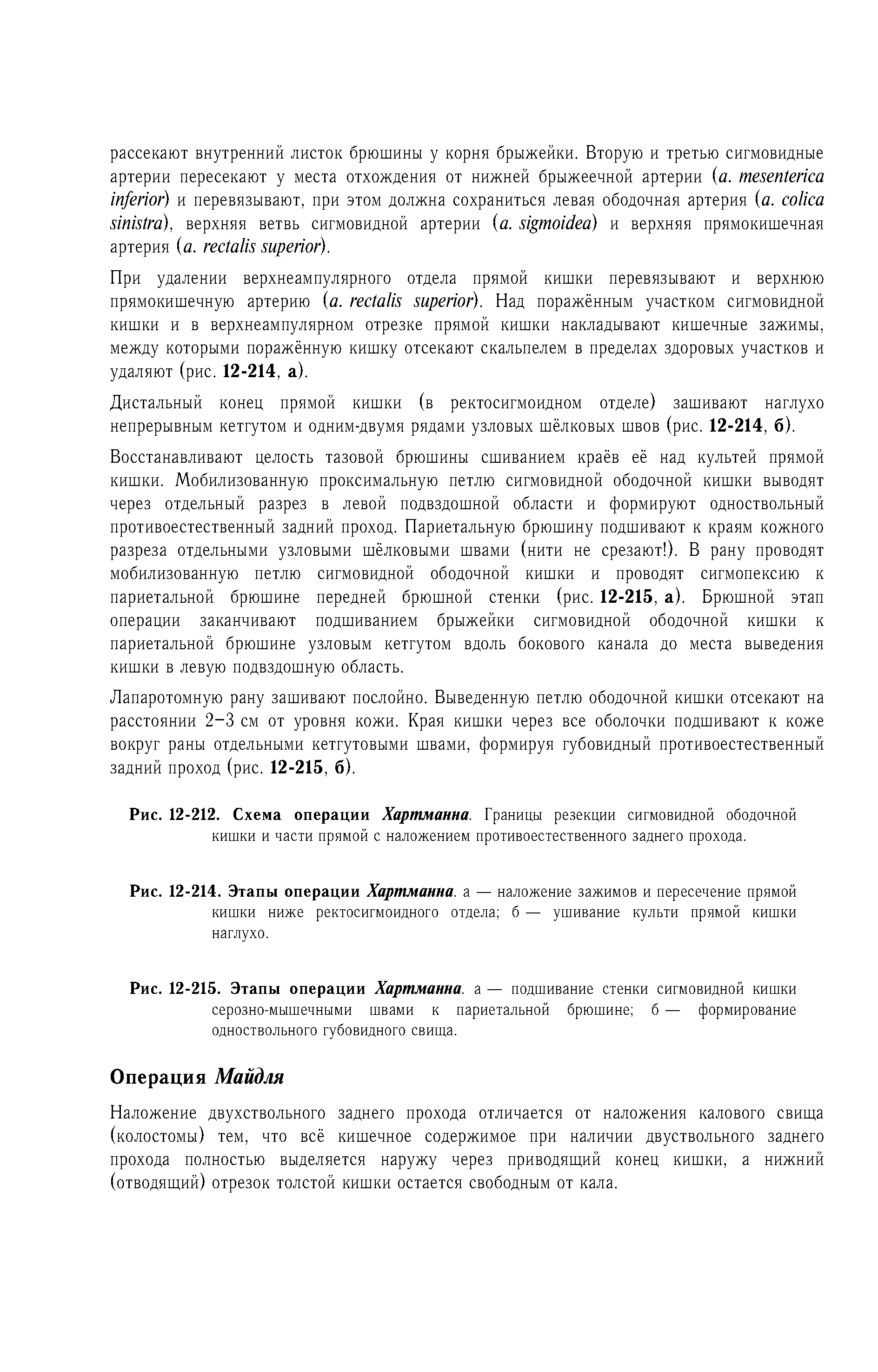 Рис. 12-214. Этапы операции Хартманна, а — наложение зажимов и пересечение прямой кишки ниже ректосигмоидного отдела б — ушивание культи прямой кишки наглухо.