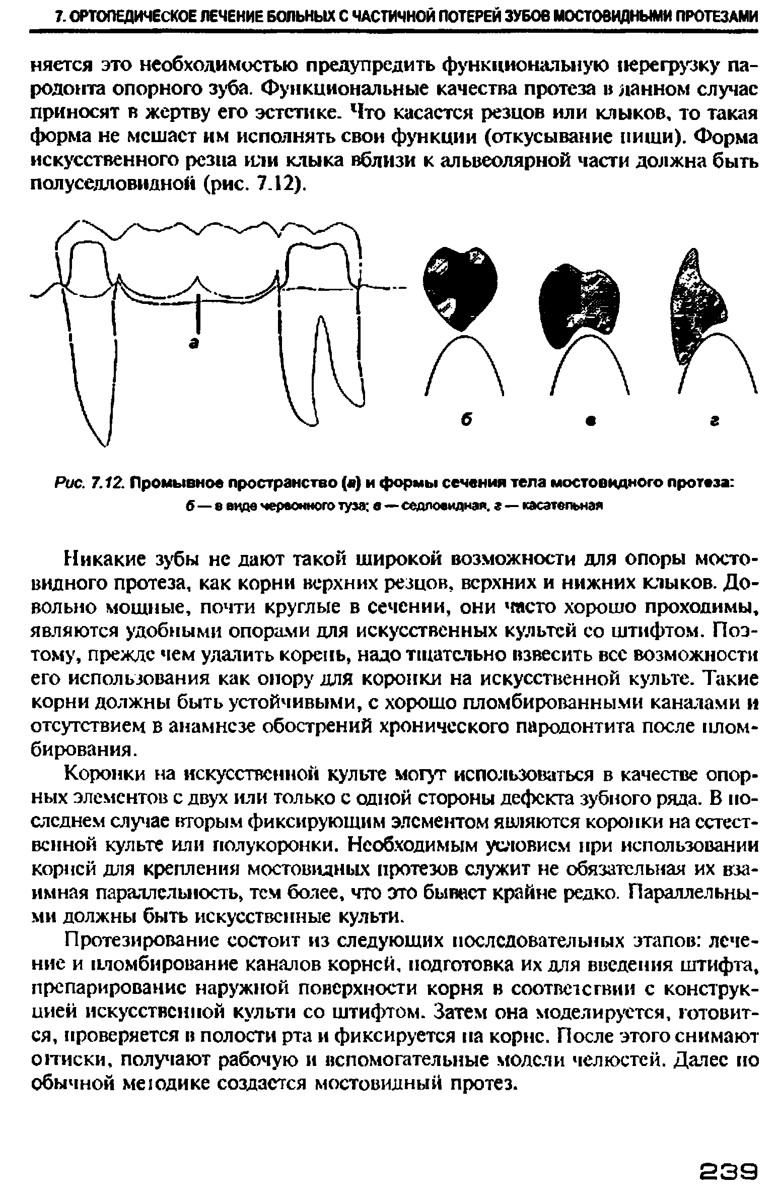 Рис. 7.12. Промывное пространство (а) и формы сечения тела мостовидного протеза ...