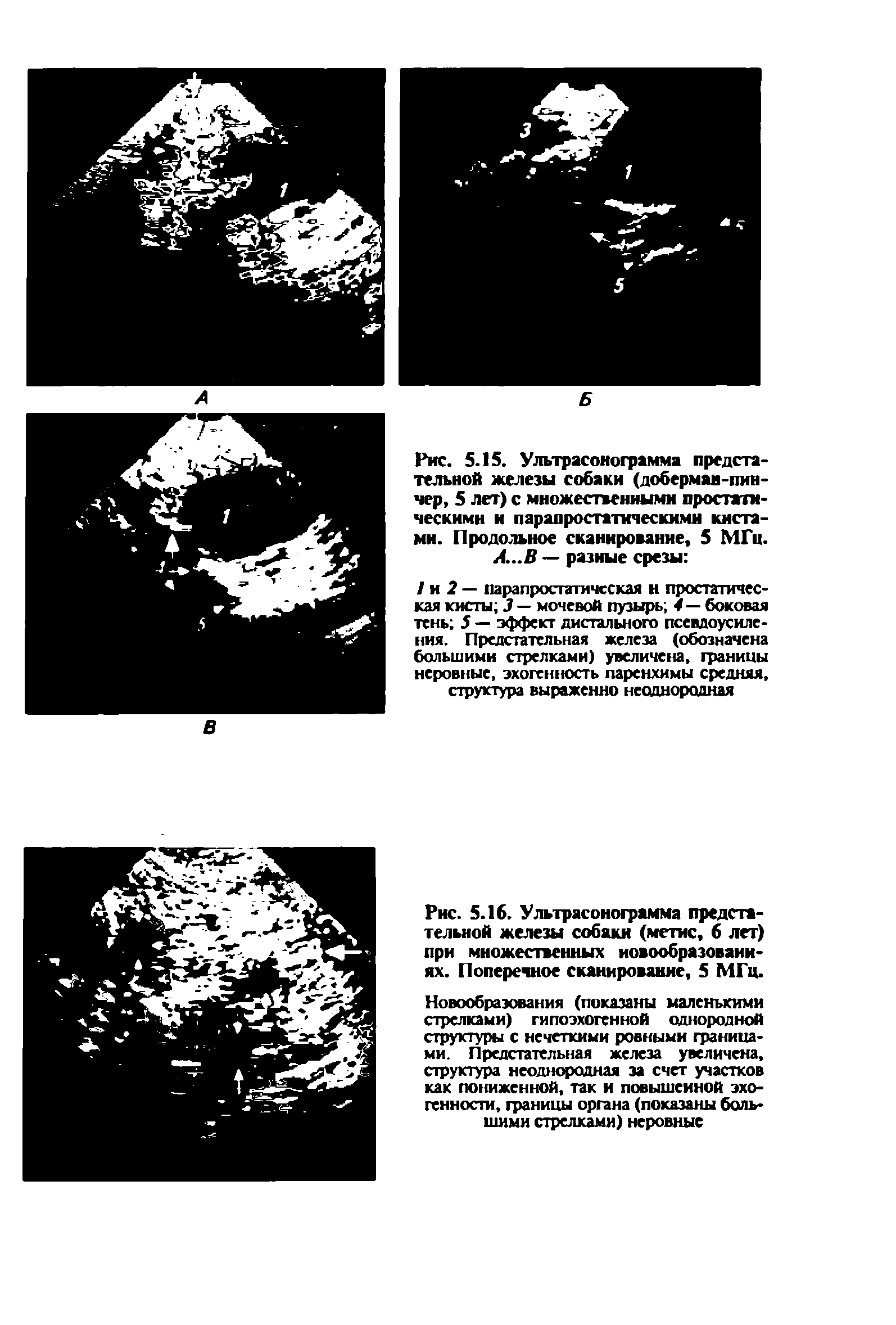 Рис. 5.15. Ультрасонограмма предстательной железы собаки (доберман-пинчер, 5 лет) с множественными простатическими и парапростатнческими кистами. Продольное сканирование, 5 МГц. А..В — разные срезы ...