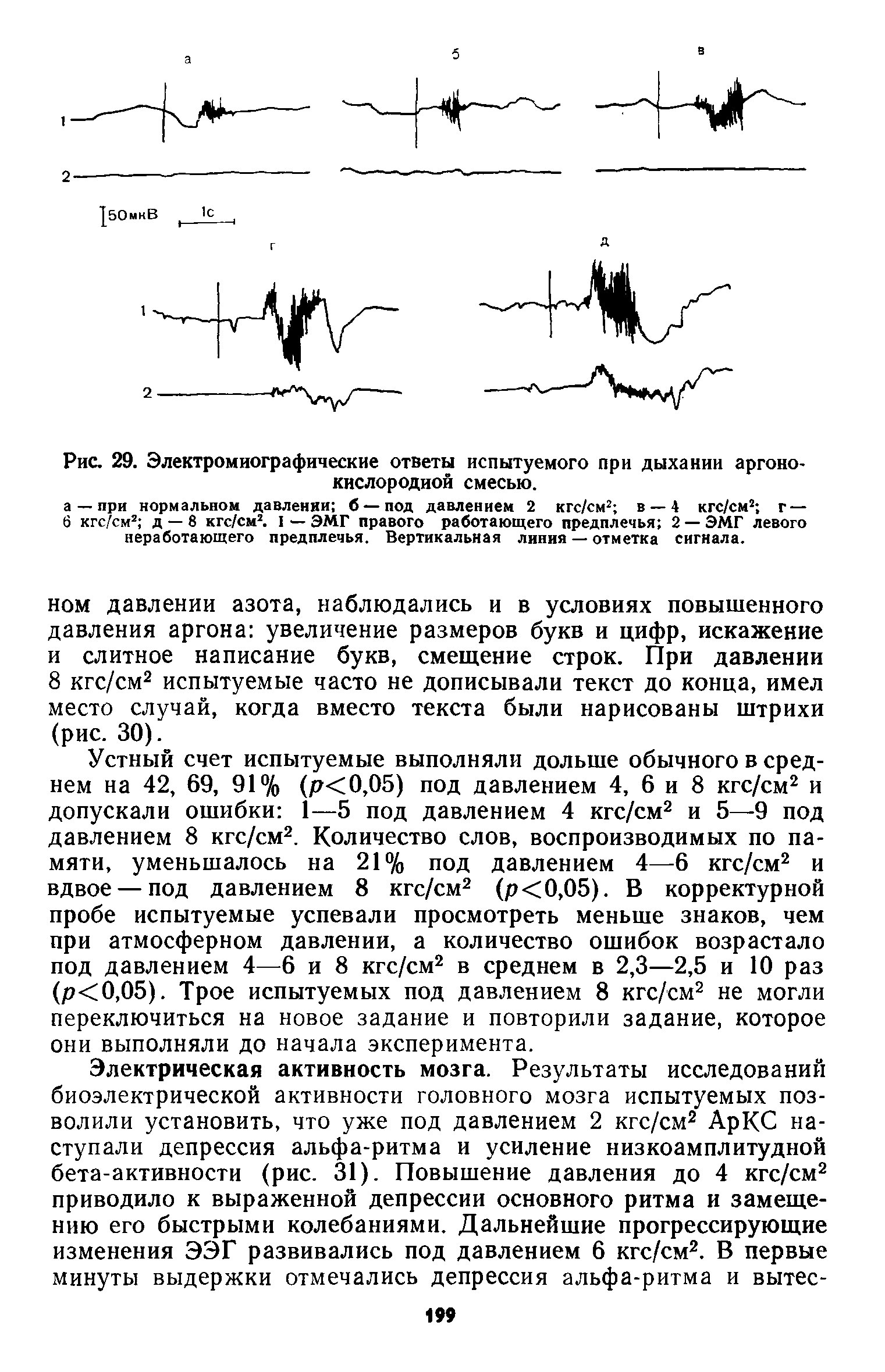 Рис. 29. Электромиографические ответы испытуемого при дыхании аргоно-кислородиой смесью.