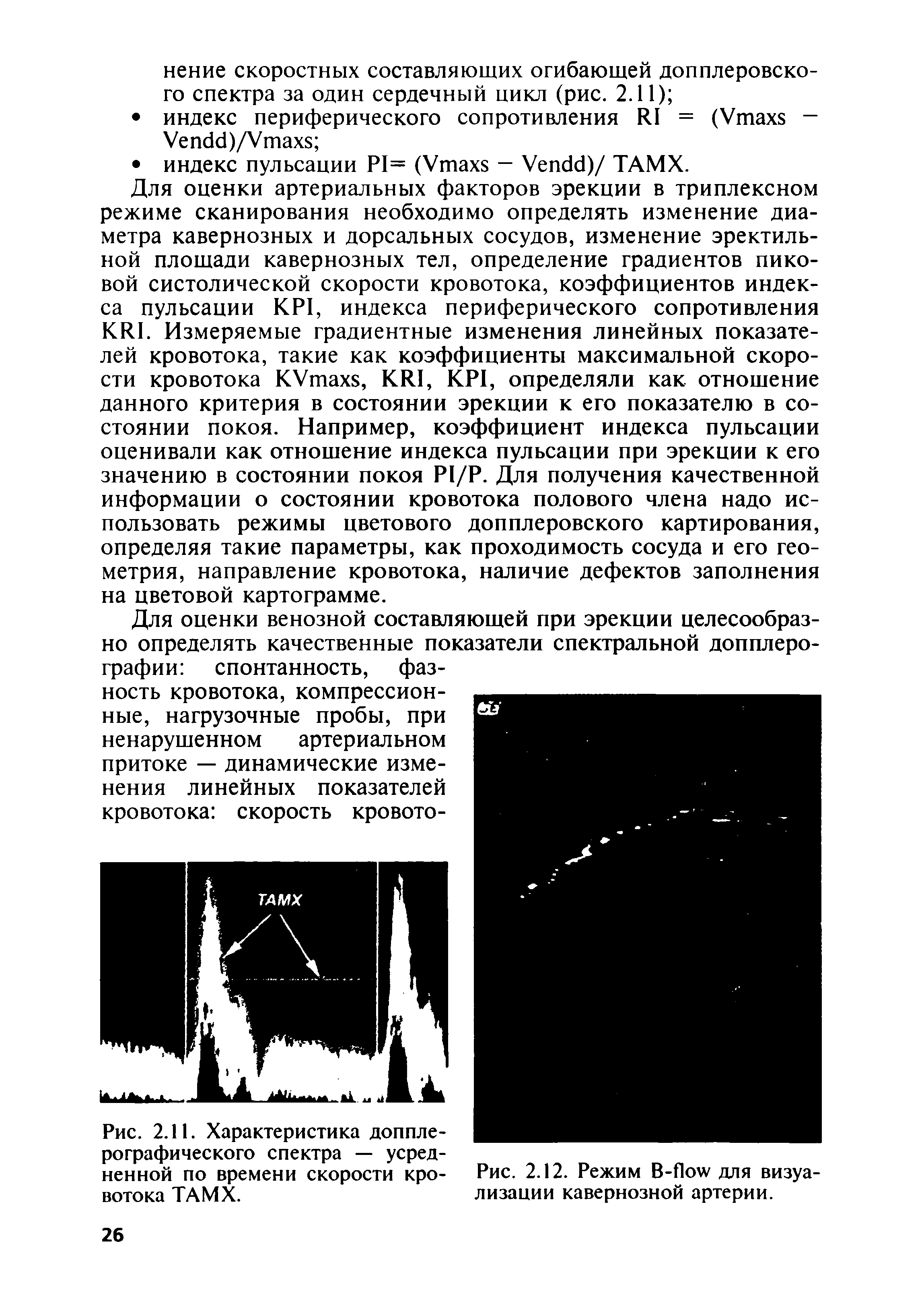 Рис. 2.11. Характеристика допплерографического спектра — усредненной по времени скорости кровотока ТАМХ.