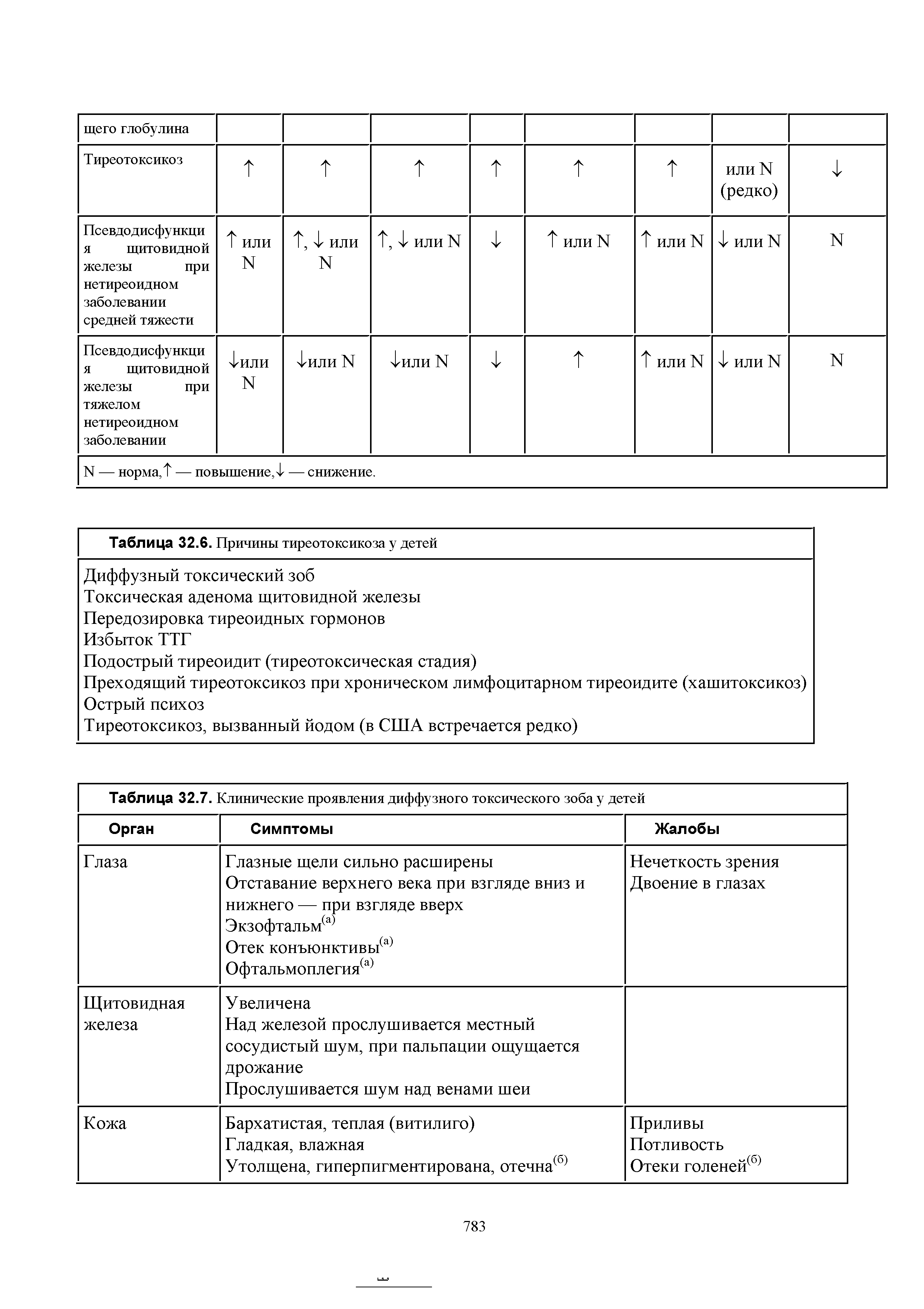 Таблица 32.7. Клинические проявления диффузного токсического зоба у детей ...