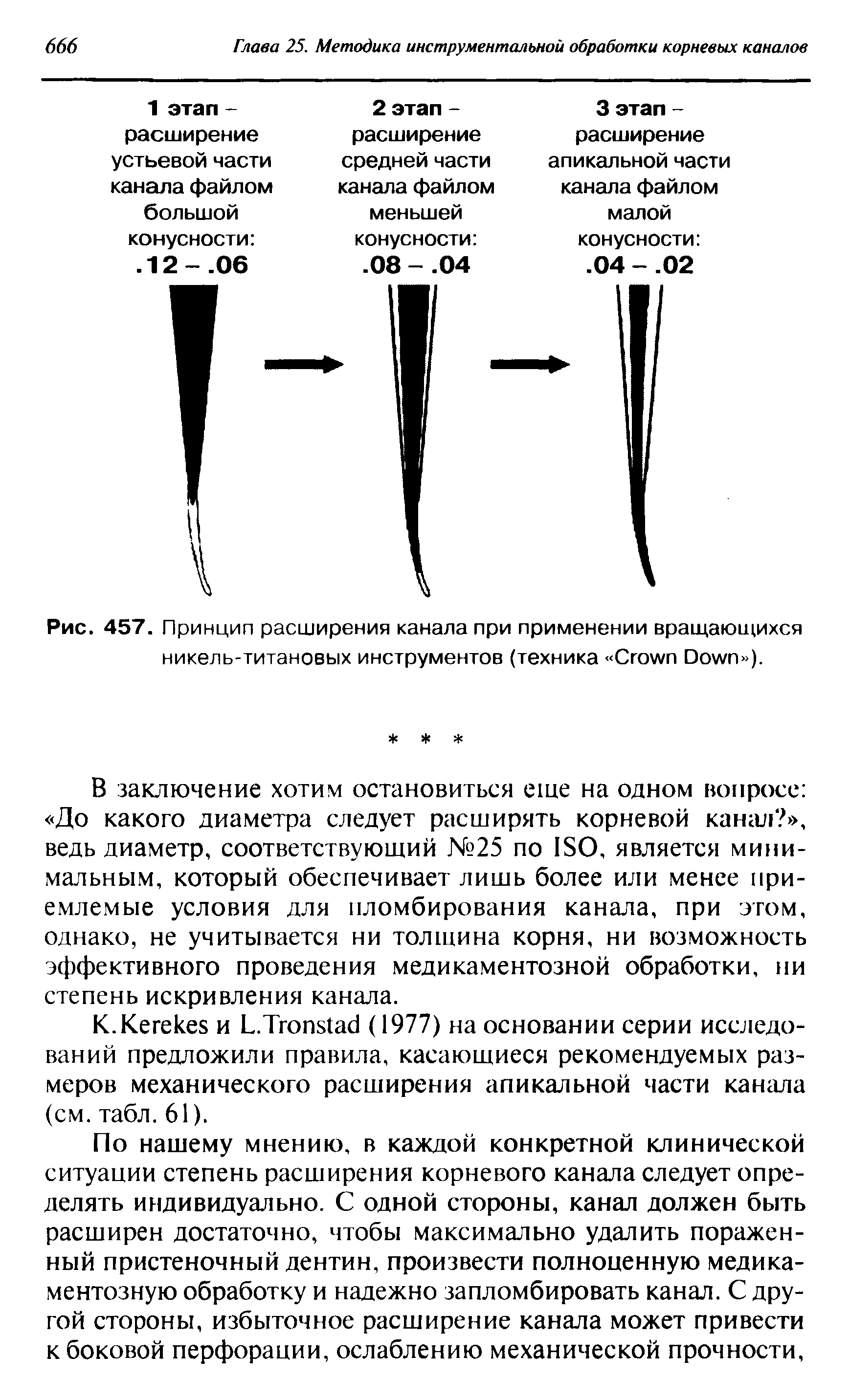 Рис. 457. Принцип расширения канала при применении вращающихся никель-титановых инструментов (техника C D ).