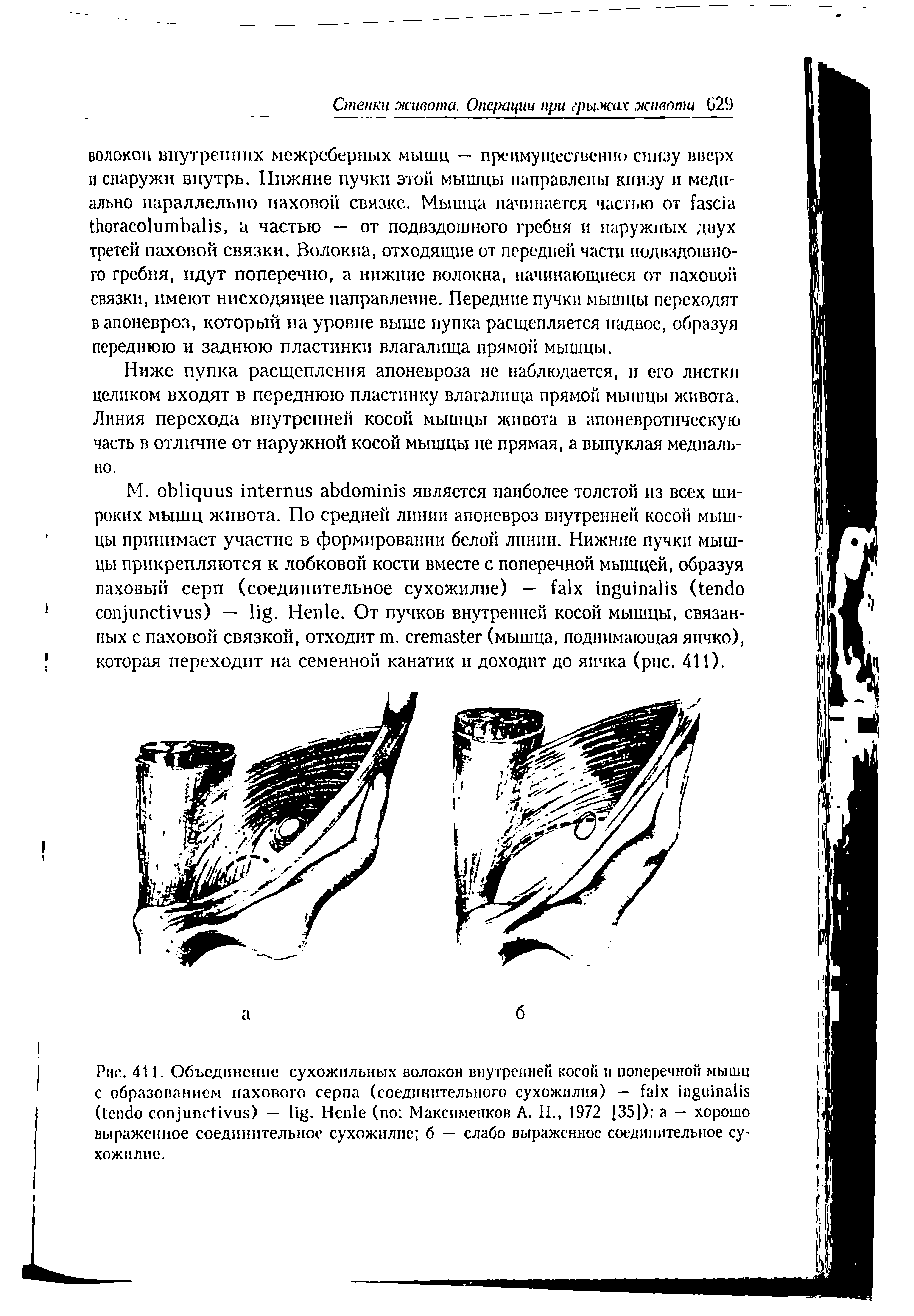 Рис. 411. Объединение сухожильных волокон внутренней косой и поперечной мышц с образованием пахового серна (соединительного сухожилия) — ( ) — . H (по Максименков A. H., 1972 [35]) — хорошо выраженное соединительное сухожилие б — слабо выраженное соединительное сухожилие.