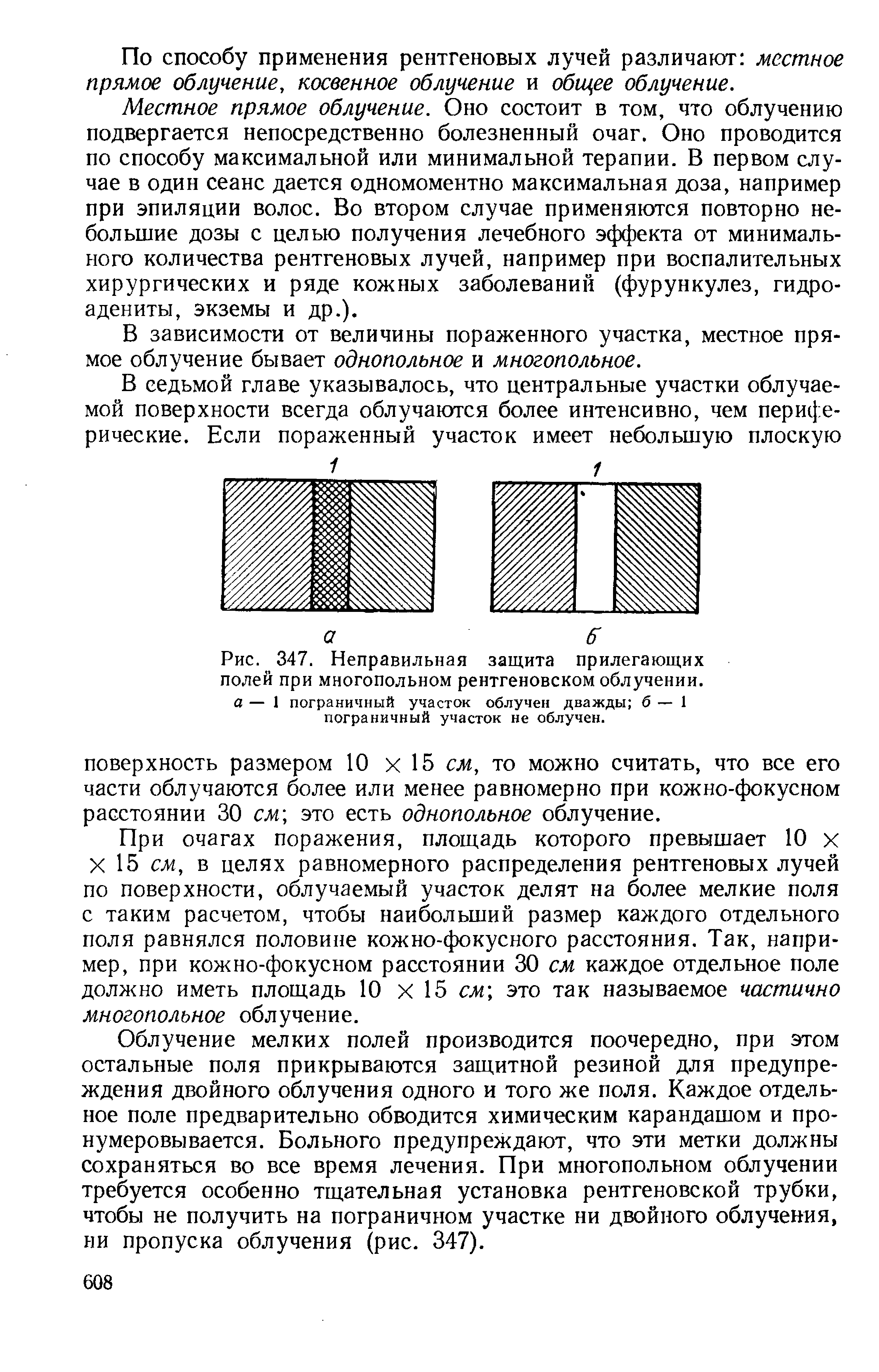 Рис. 347. Неправильная защита прилегающих полей при многопольном рентгеновском облучении.