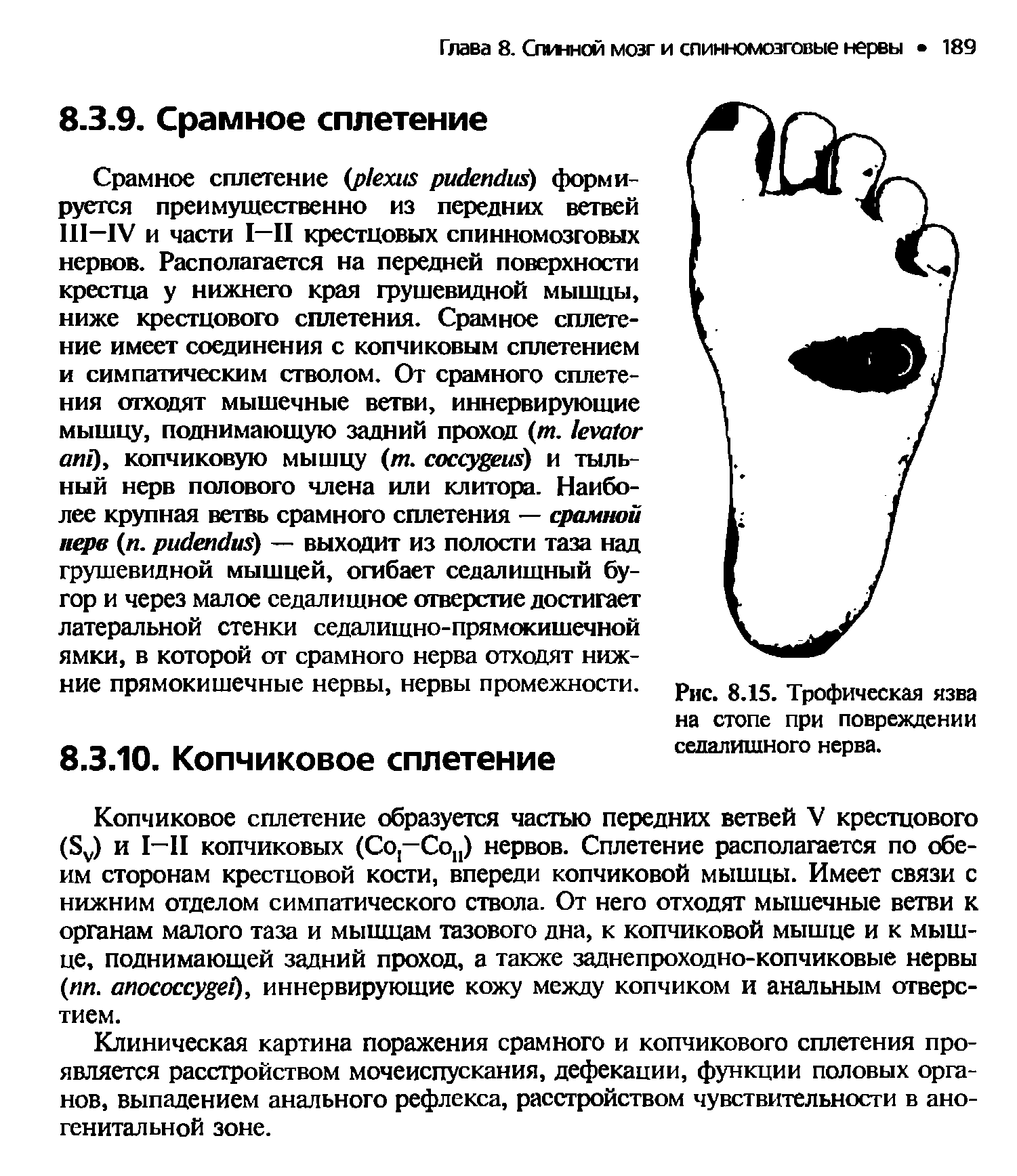 Рис. 8.15. Трофическая язва на стопе при повреждении седалищного нерва.