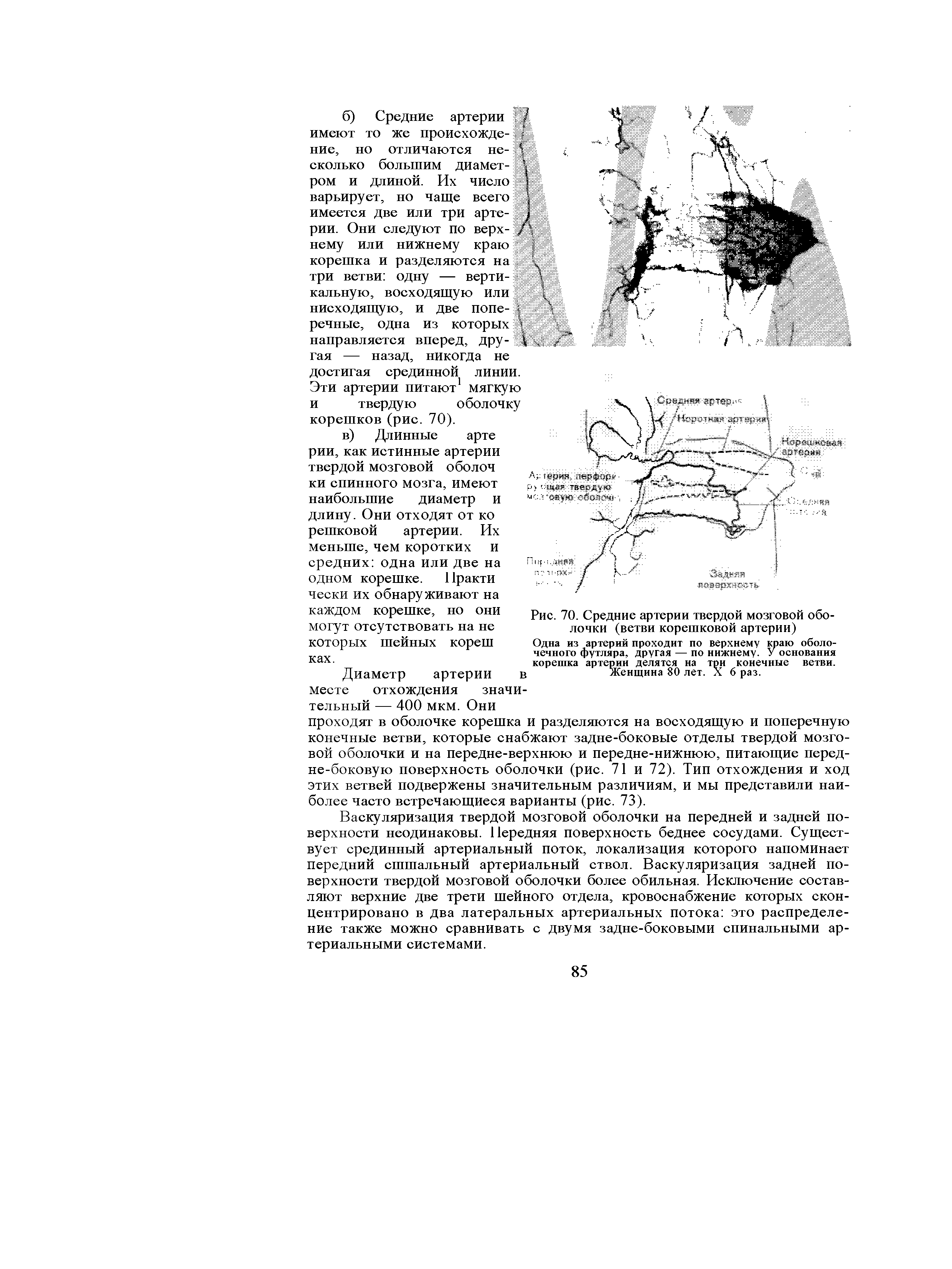 Рис. 70. Средние артерии твердой мозговой оболочки (ветви корешковой артерии)...