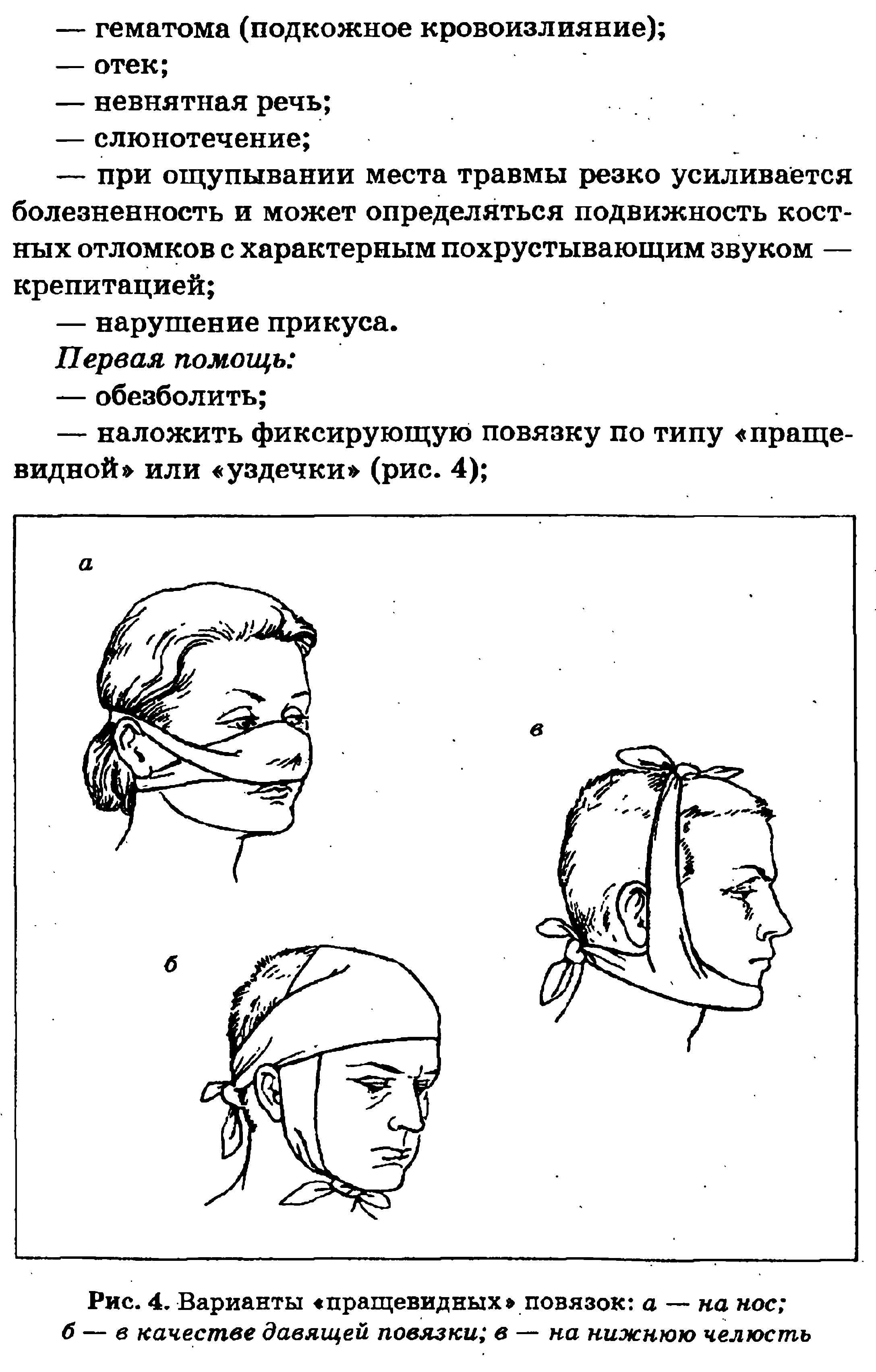 Рис. 4. Варианты пращевидных повязок а — на нос б — в качестве давящей повязки в — на нижнюю челюсть...