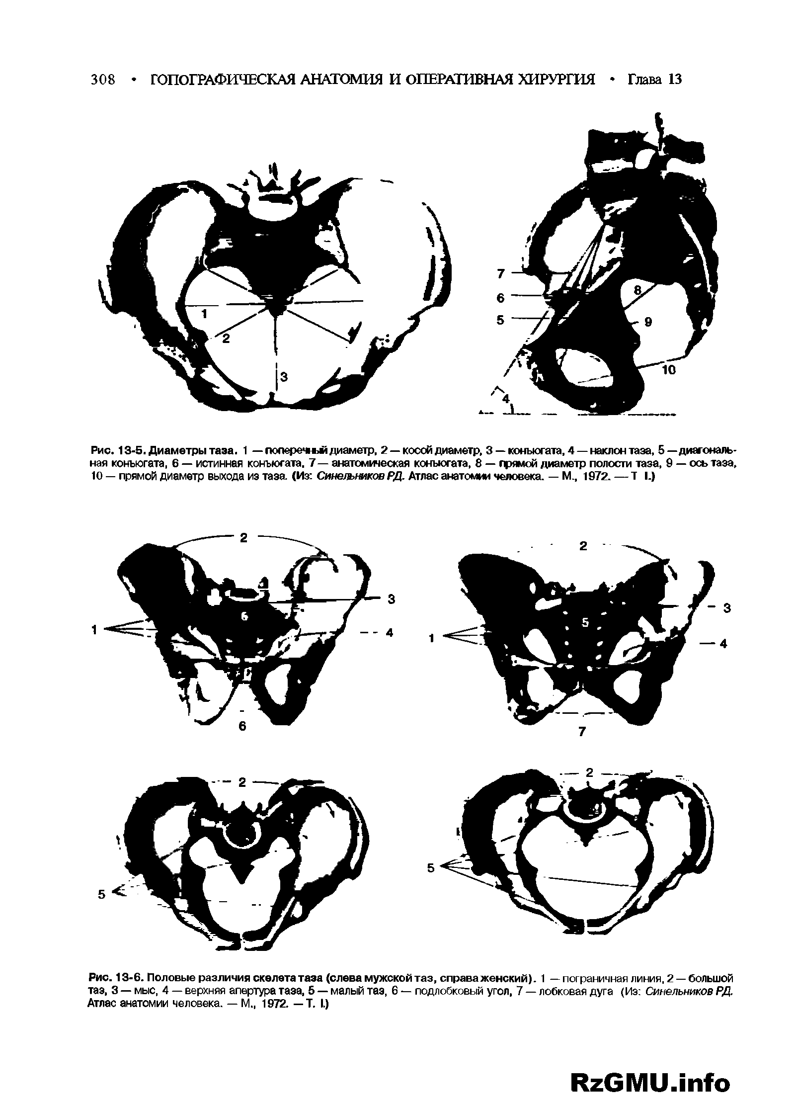Рис. 13-6. Половые различия скелета таза (слева мужской таз, справаженский). 1 — пограничная линия, 2 —большой таз, 3 — мыс, 4 — верхняя апертура таза, 5 — малый таз, 6 — подлобковый угол, 7 — лобковая дуга (Из Синельников РД. Атлас анатомии человека. — М., 1972. — Т. I.)...