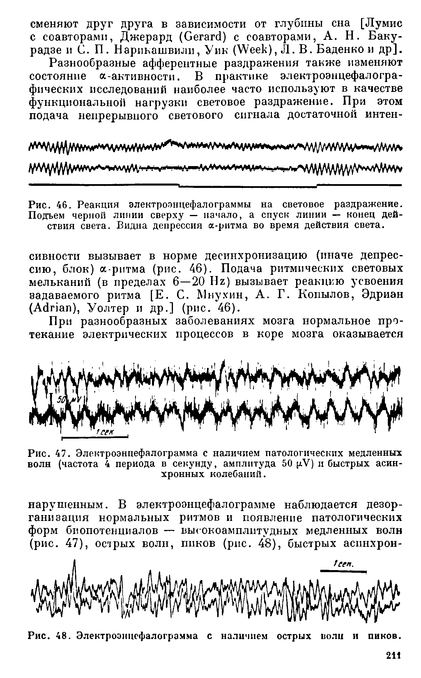 Рис. 46. Реакция электроэнцефалограммы на световое раздражение. Подъем черной линии сверху — начало, а спуск линии — конец действия света. Видна депрессия -ритма во время действия света.