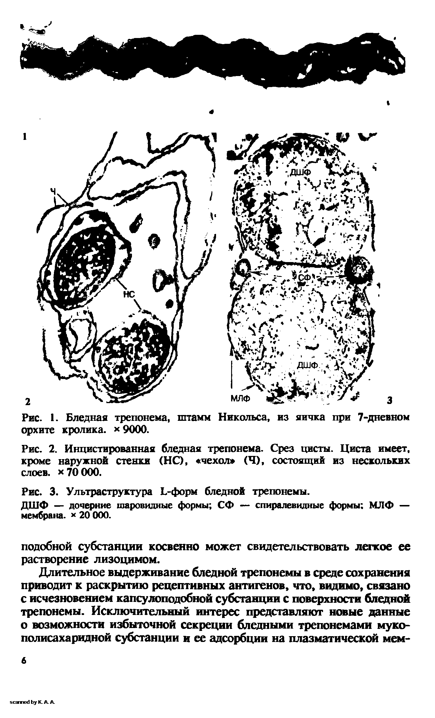 Рис. 2. Инцистированная бледная трепонема. Срез цисты. Циста имеет, кроме наружной стенки (НО, чехол (Ч), состоящий из нескольких слоев. 70 000.