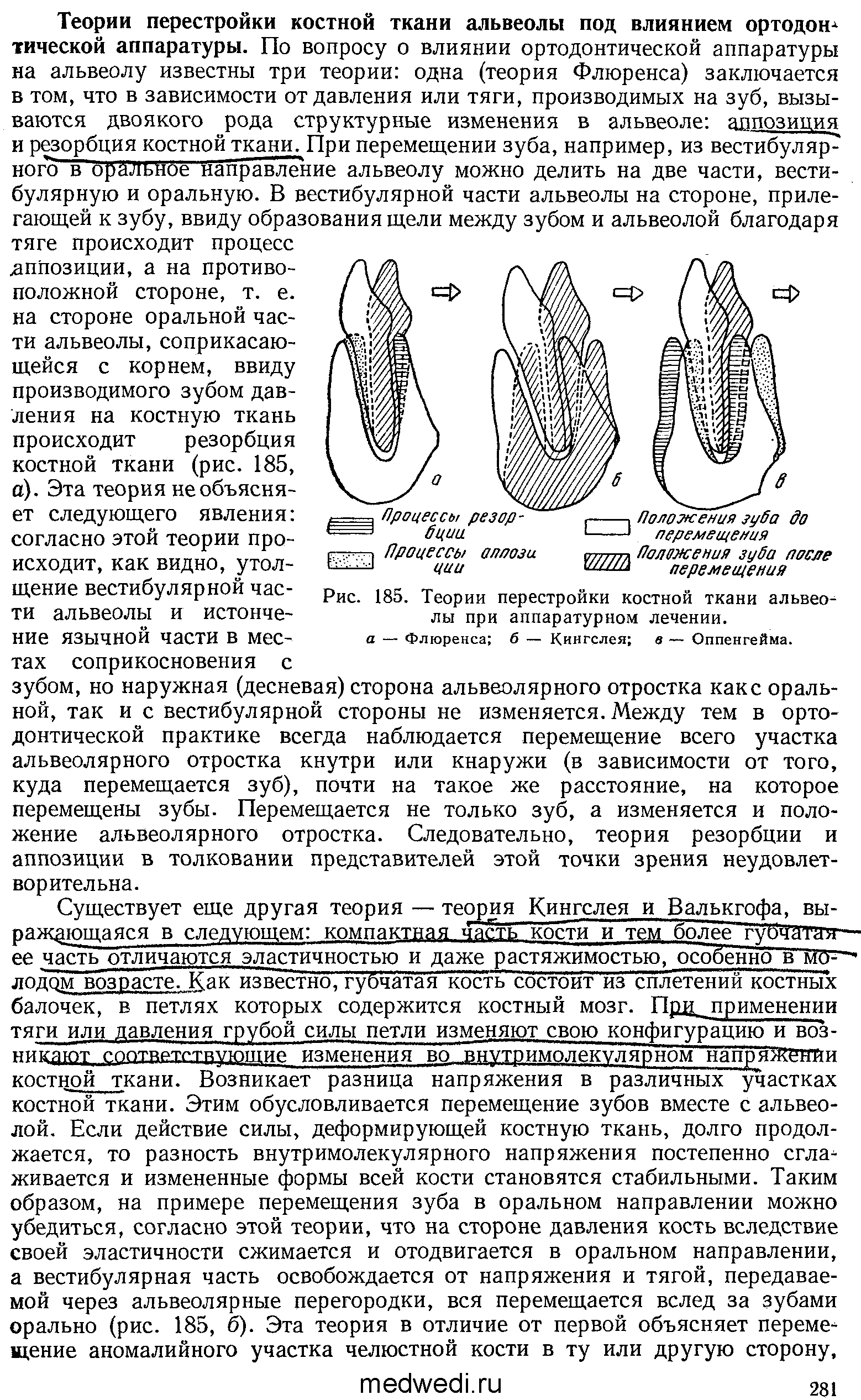 Рис. 185. Теории перестройки костной ткани альвеолы при аппаратурном лечении. а — Флюренса б — Кингслея в — Оппенгейма.