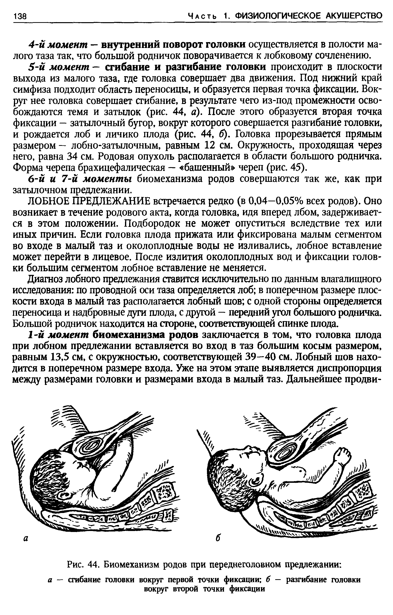 Рис. 44. Биомеханизм родов при переднеголовном предлежании а — сгибание головки вокруг первой точки фиксации б — разгибание головки вокруг второй точки фиксации...