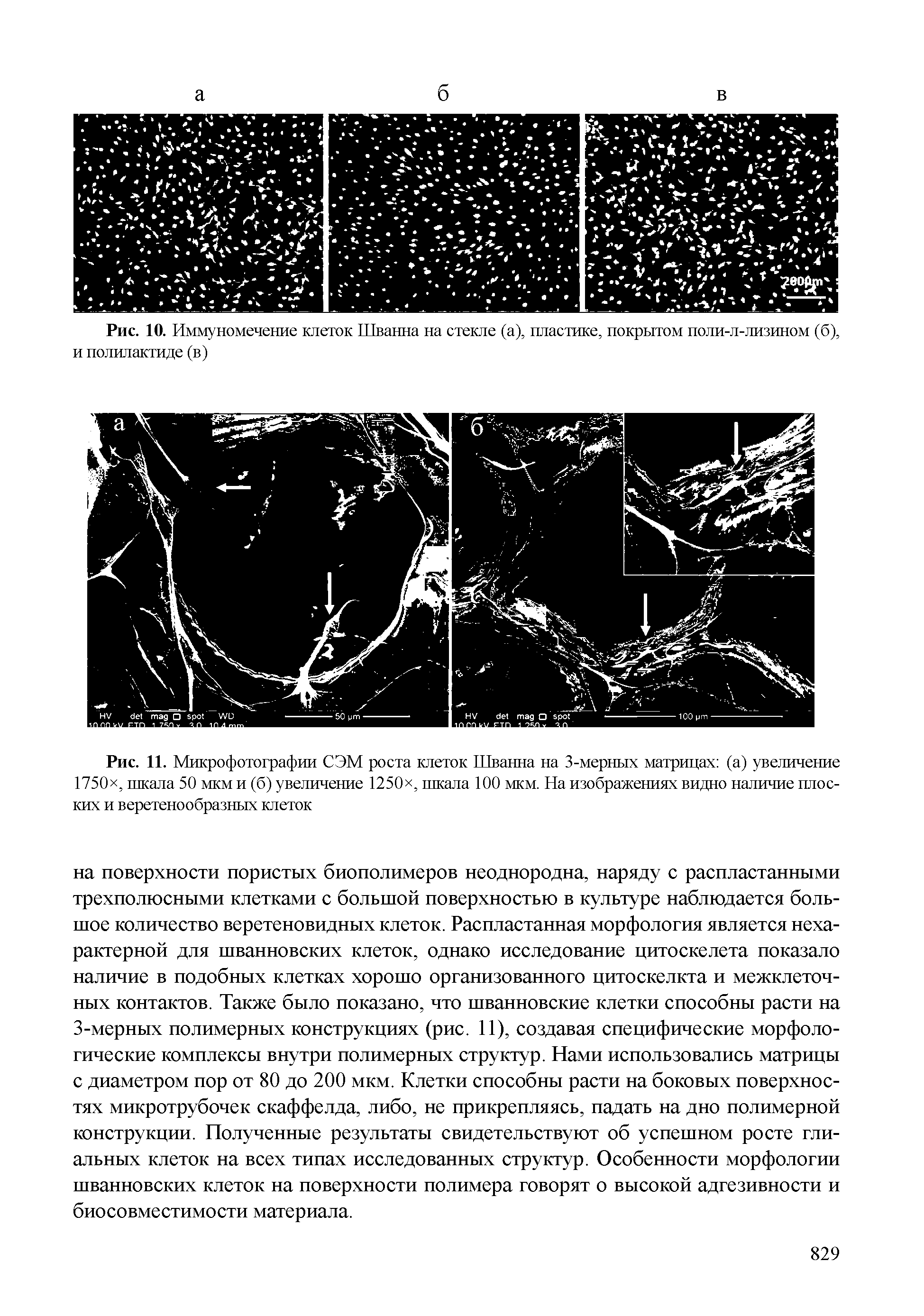 Рис. 10. Иммуномечение клеток Шванна на стекле (а), пластике, покрытом поли-л-лизином (б), и полилактиде (в)...