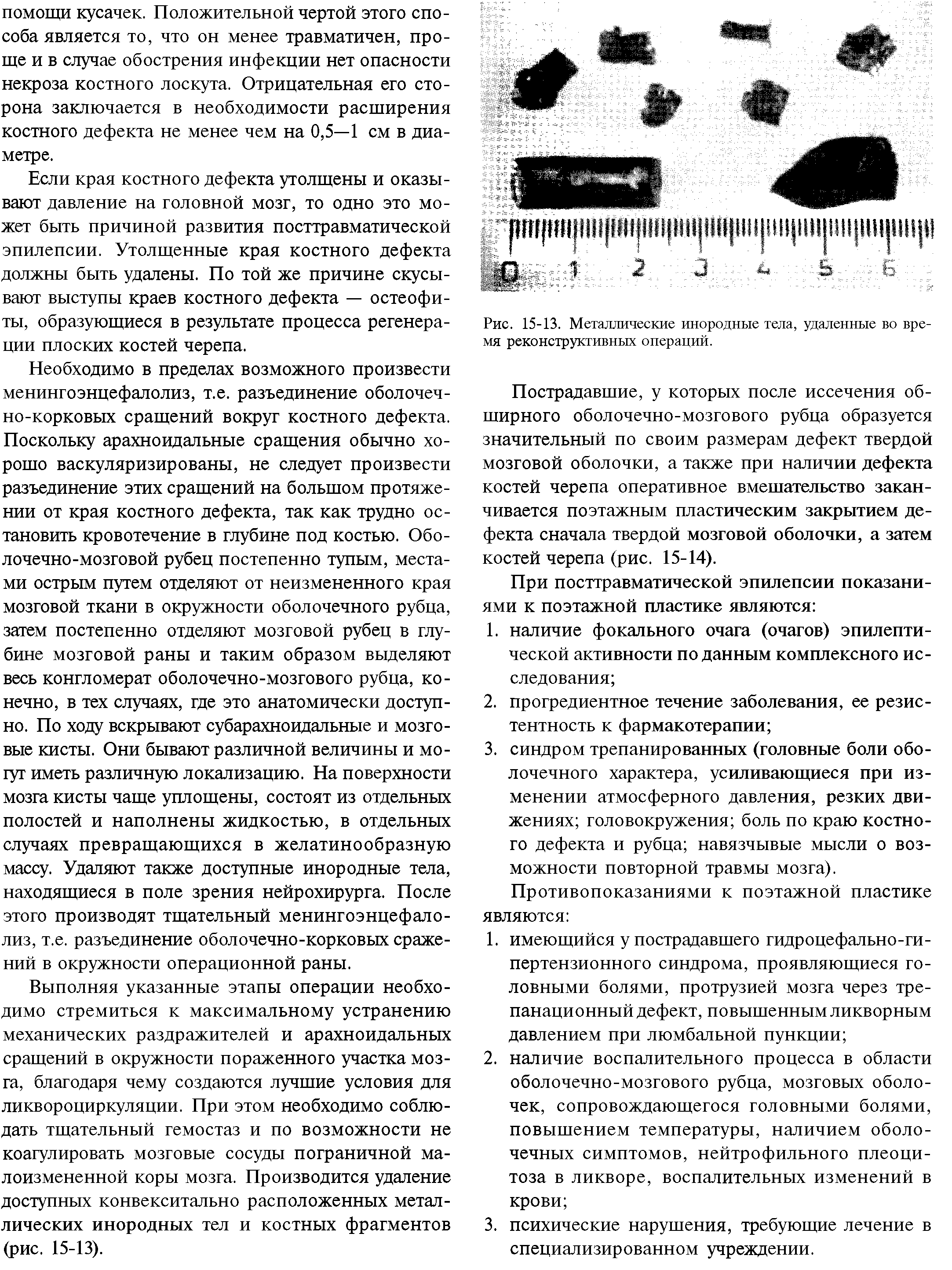 Рис. 15-13. Металлические инородные тела, удаленные во время реконструктивных операций.